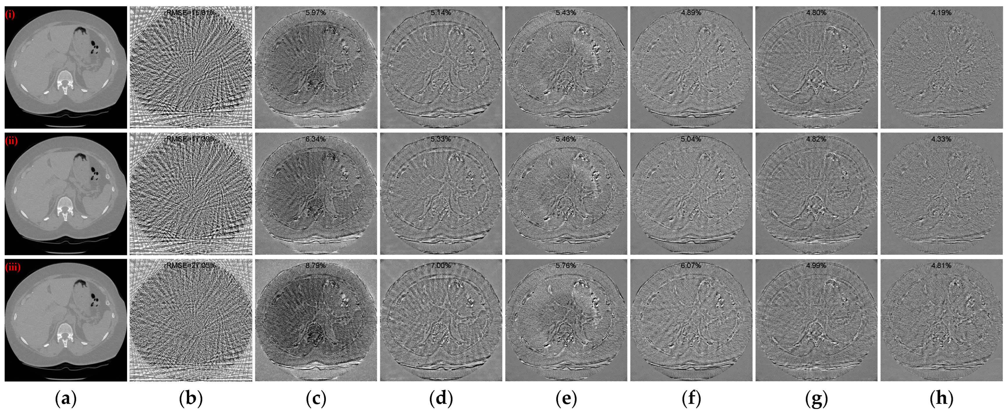 Tomography 10 00011 g010