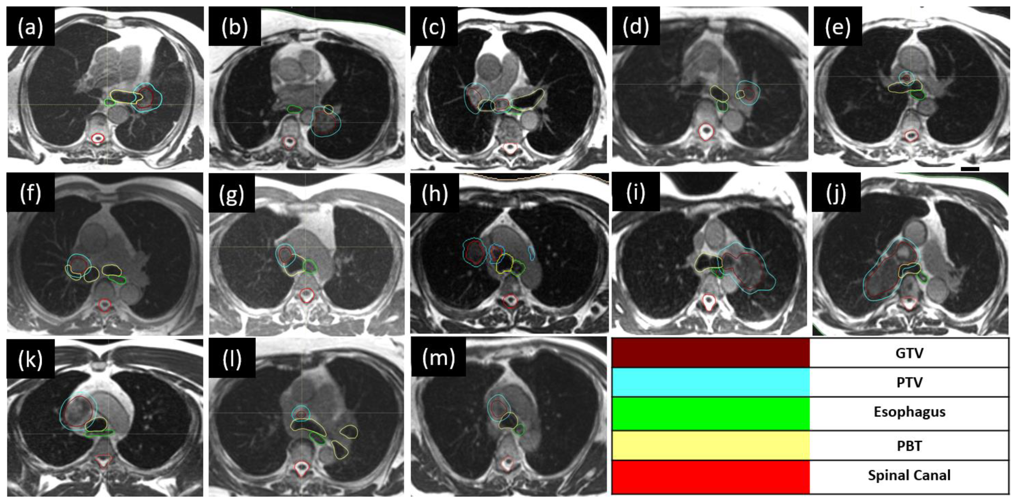 Tomography 10 00013 g001