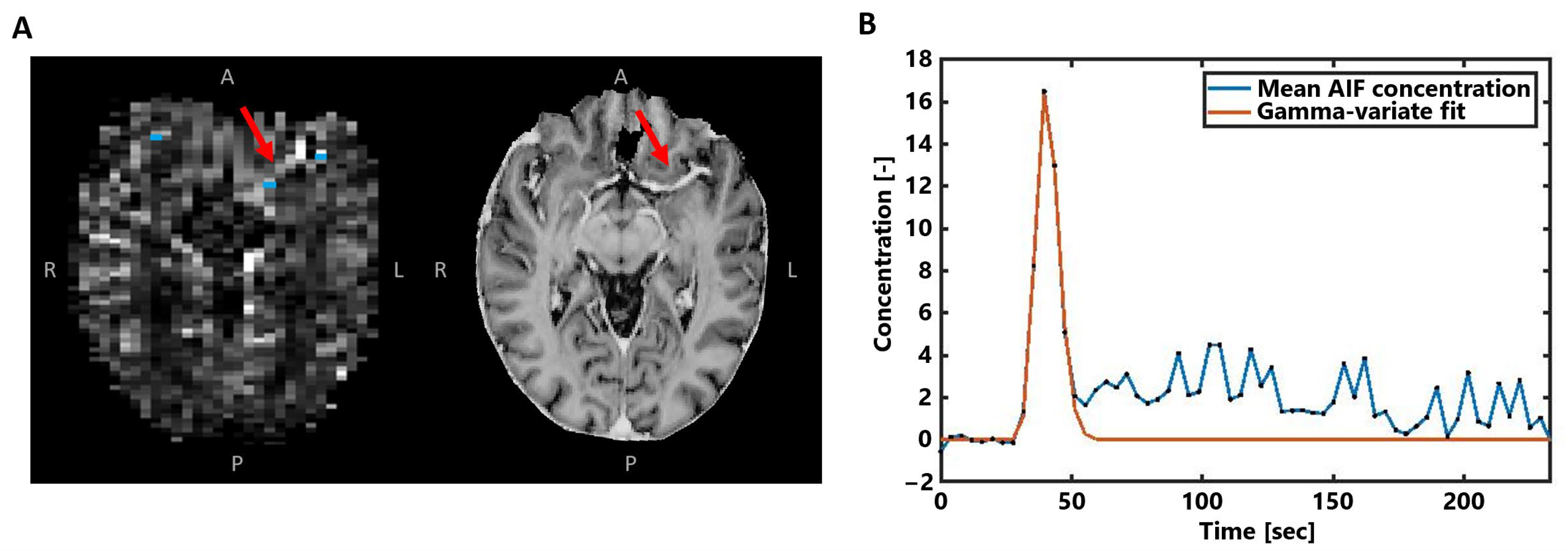 Tomography 10 00014 g002