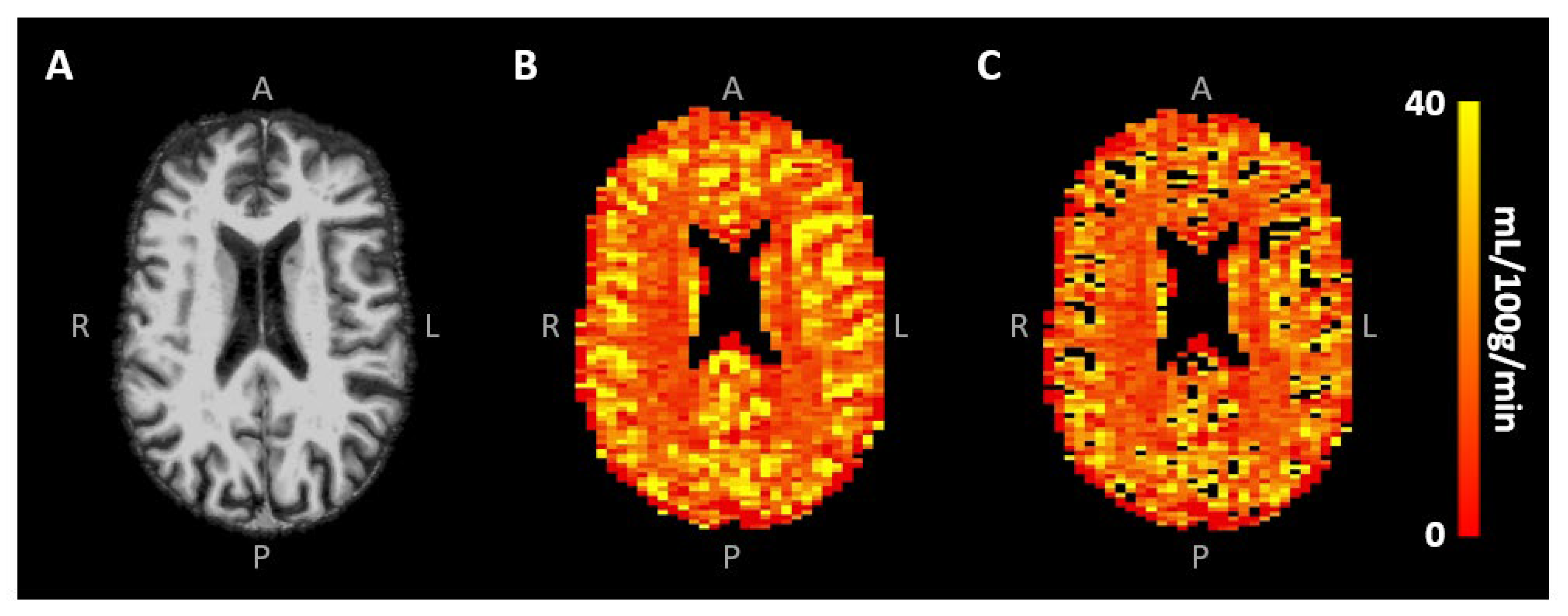 Tomography 10 00014 g003