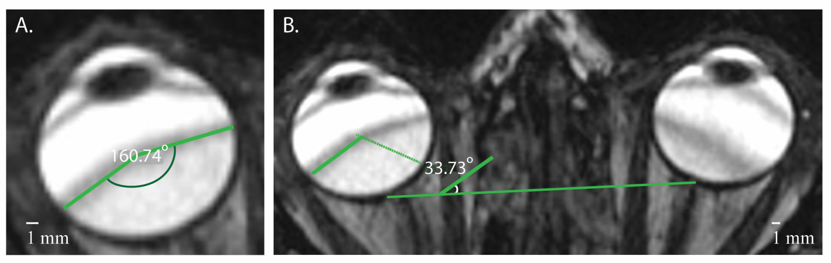 Tomography 10 00016 g002
