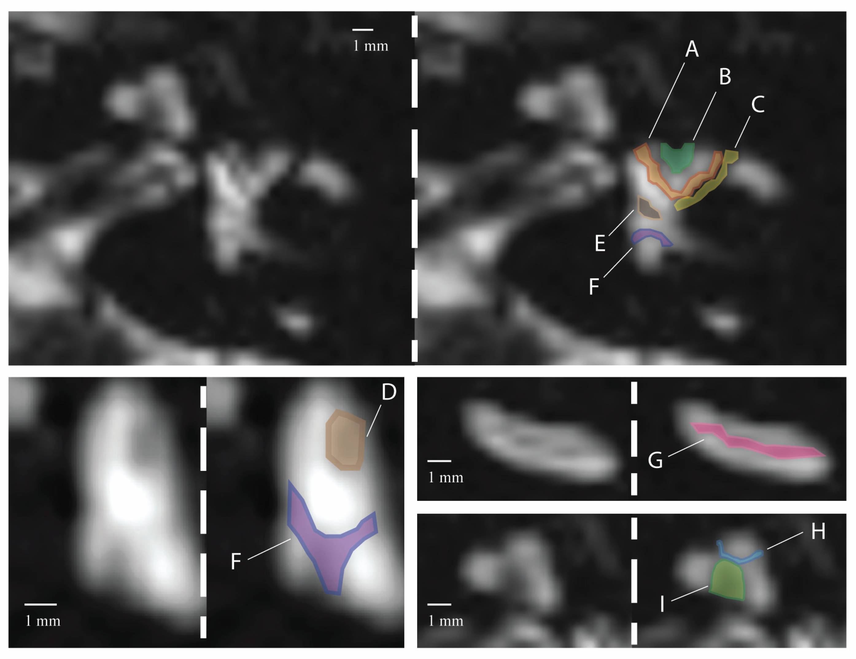 Tomography 10 00016 g003
