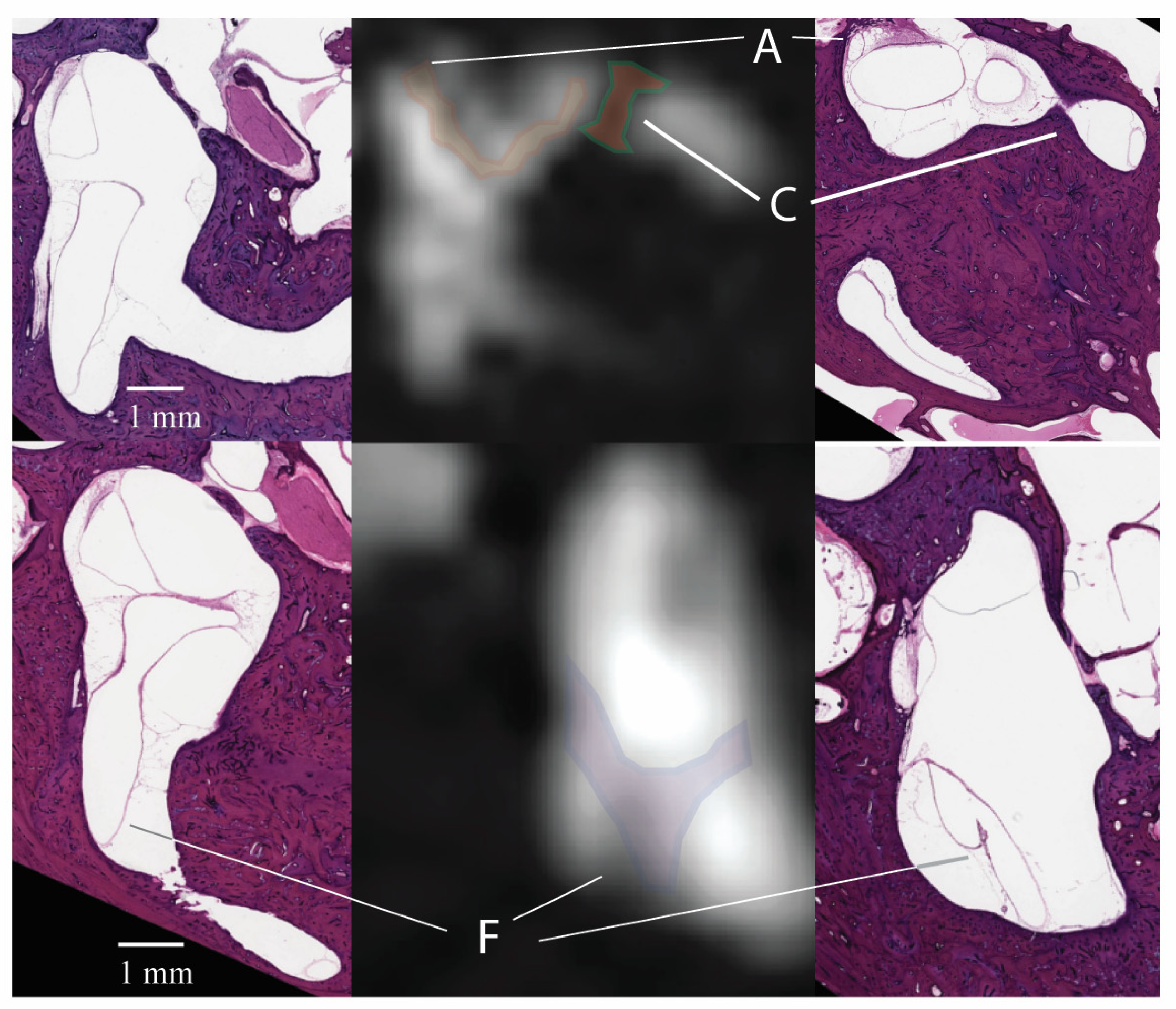 Tomography 10 00016 g004