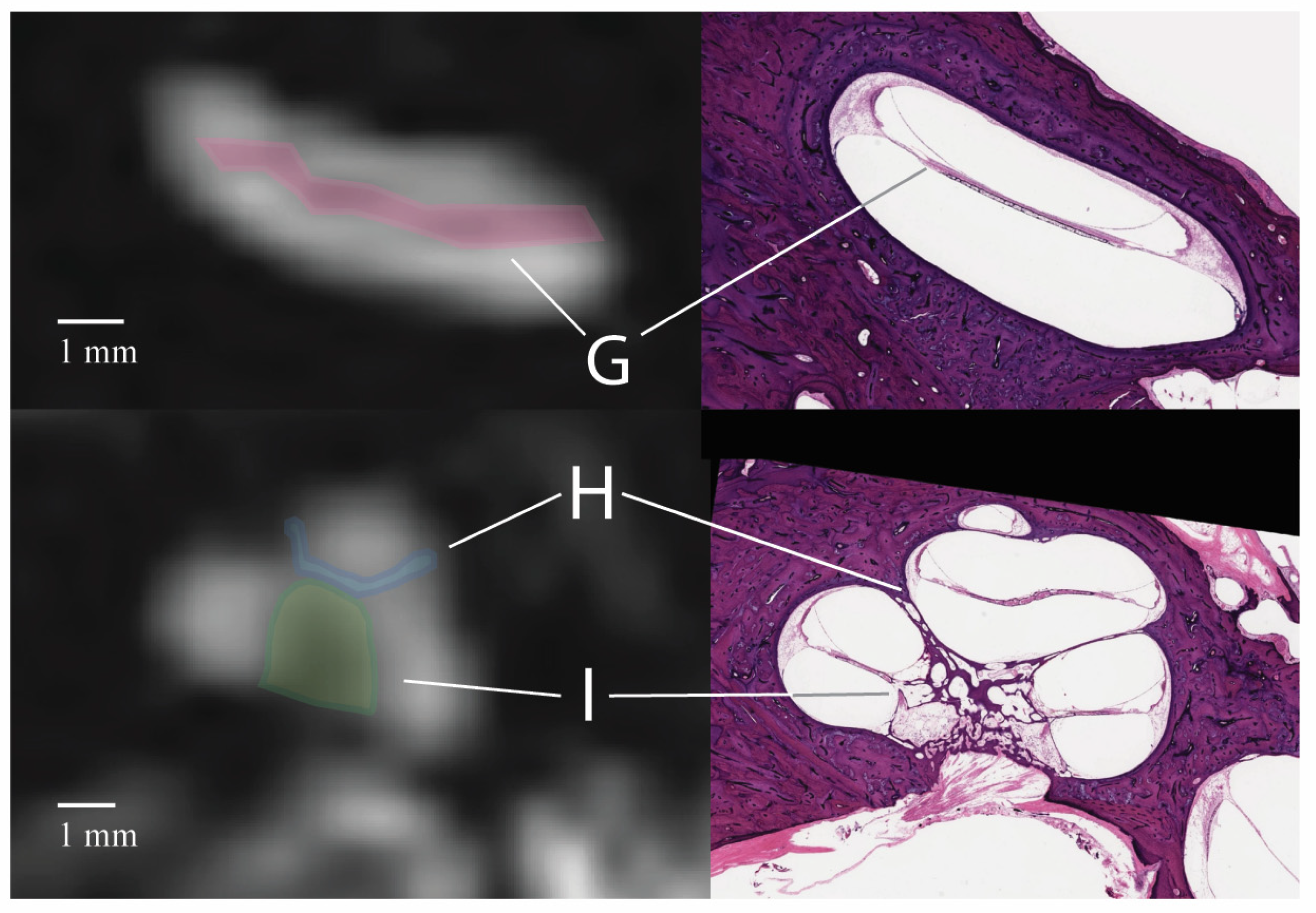 Tomography 10 00016 g005