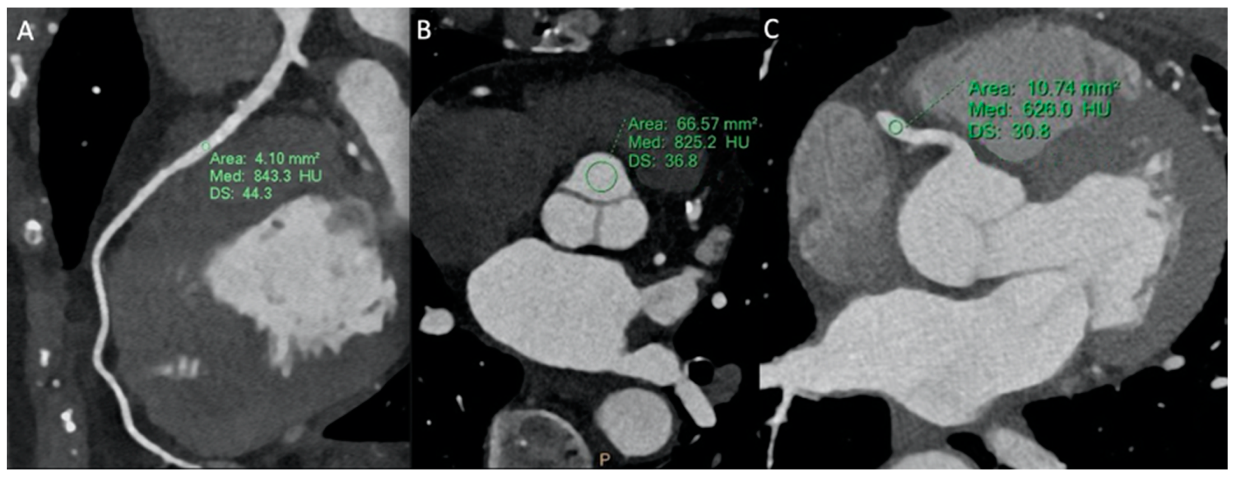 Tomography 10 00023 g002