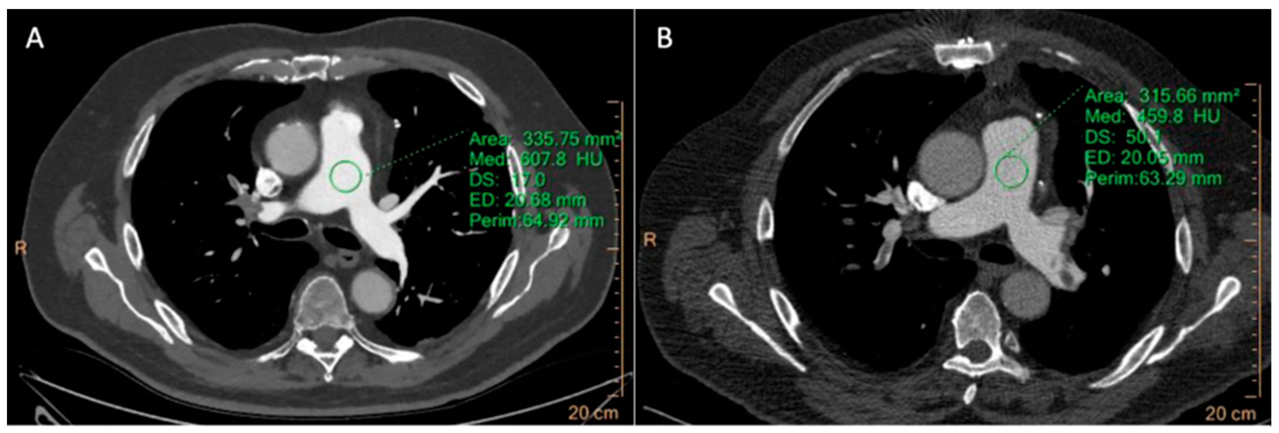 Tomography 10 00023 g003