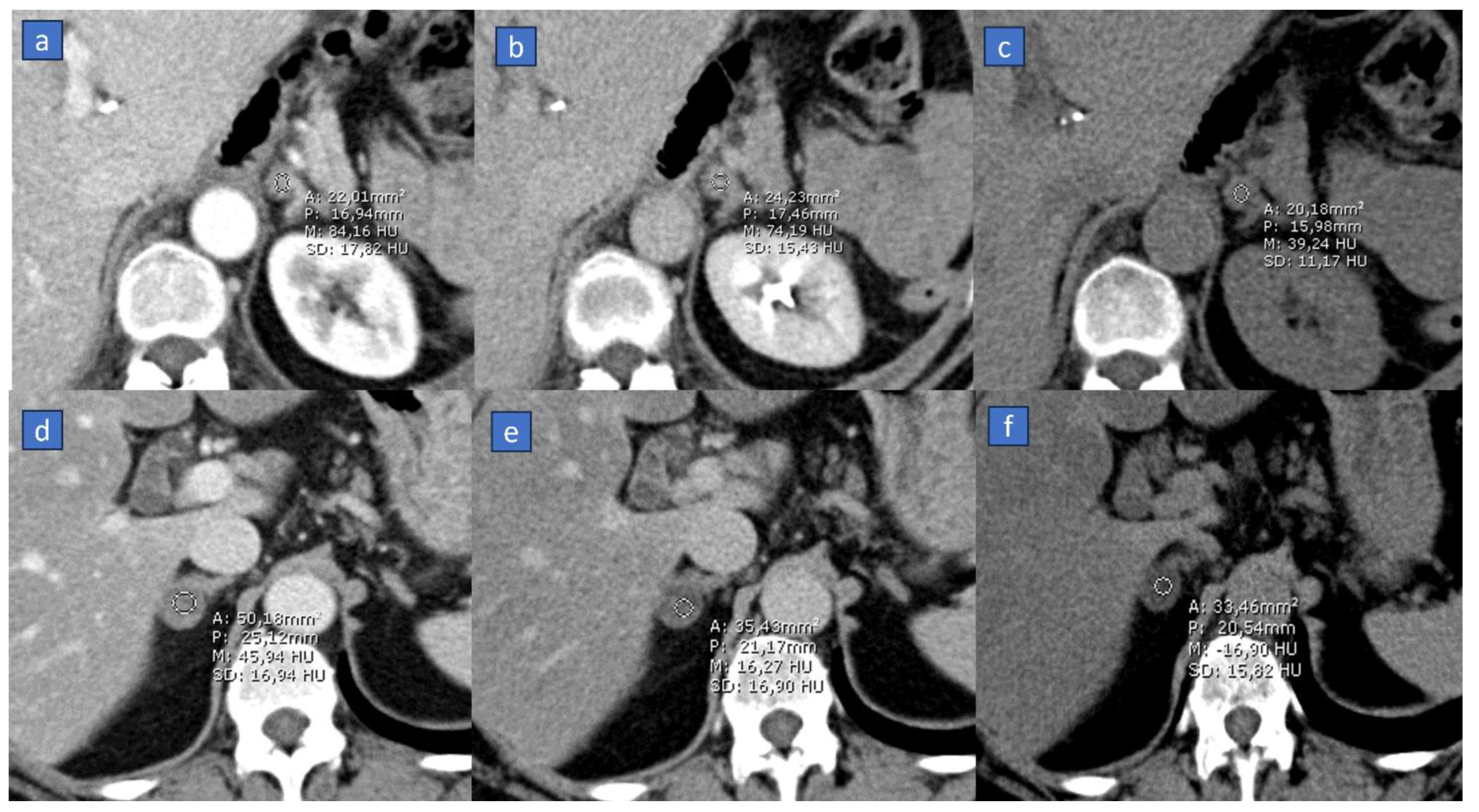 Tomography 10 00024 g002