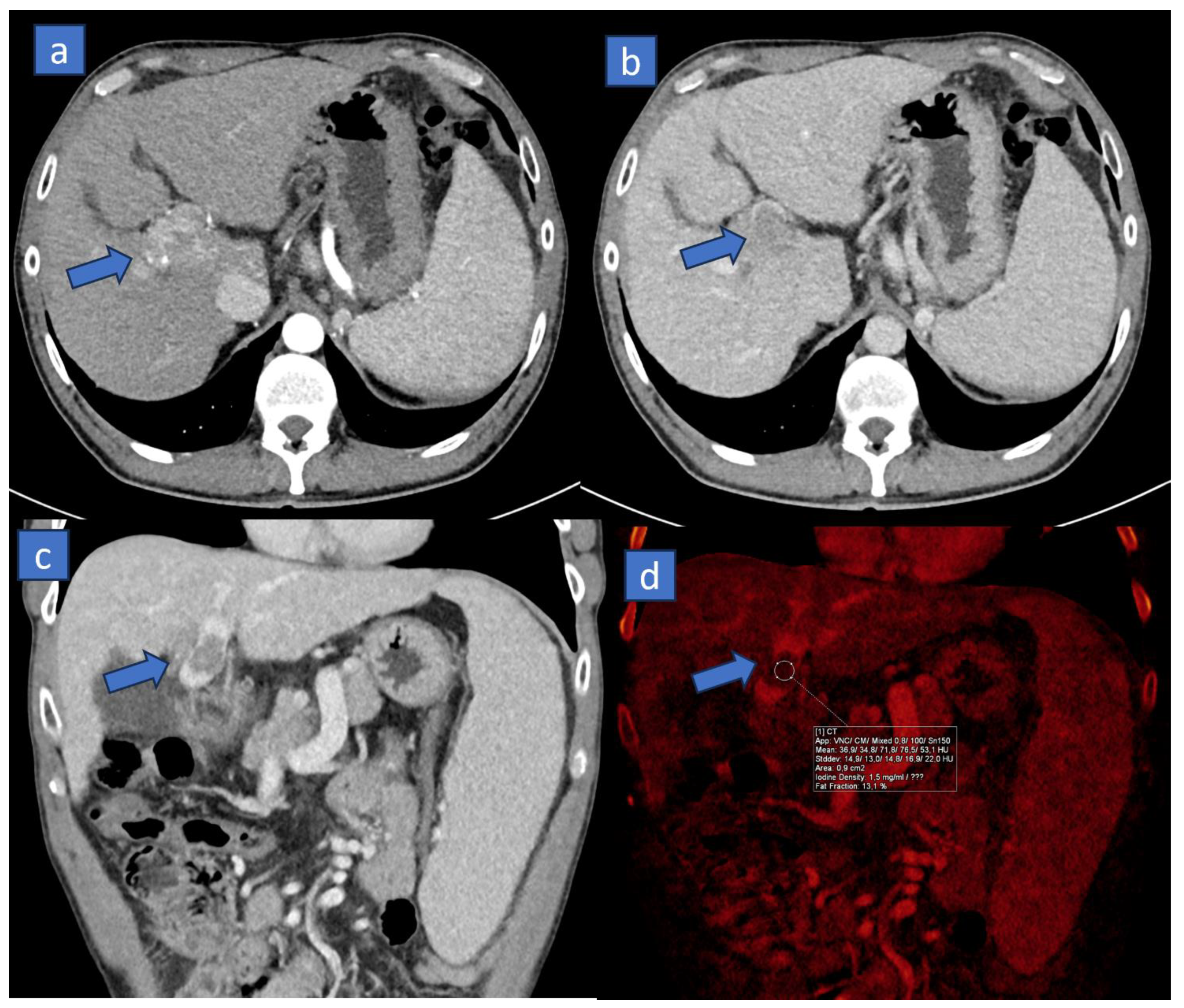 Tomography 10 00024 g003