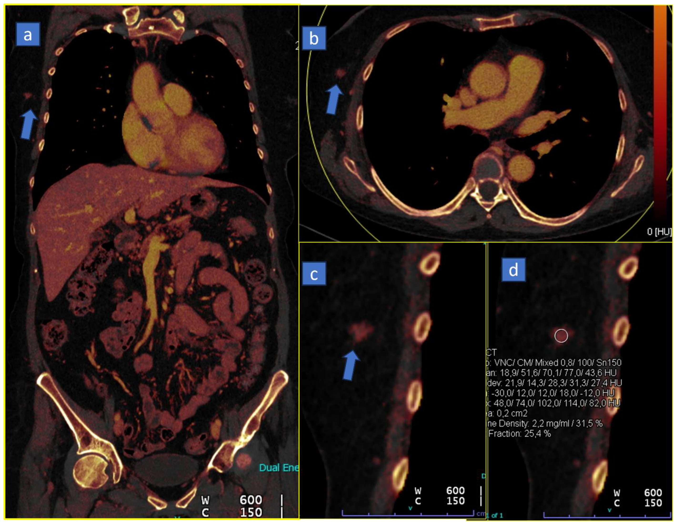 Tomography 10 00024 g005