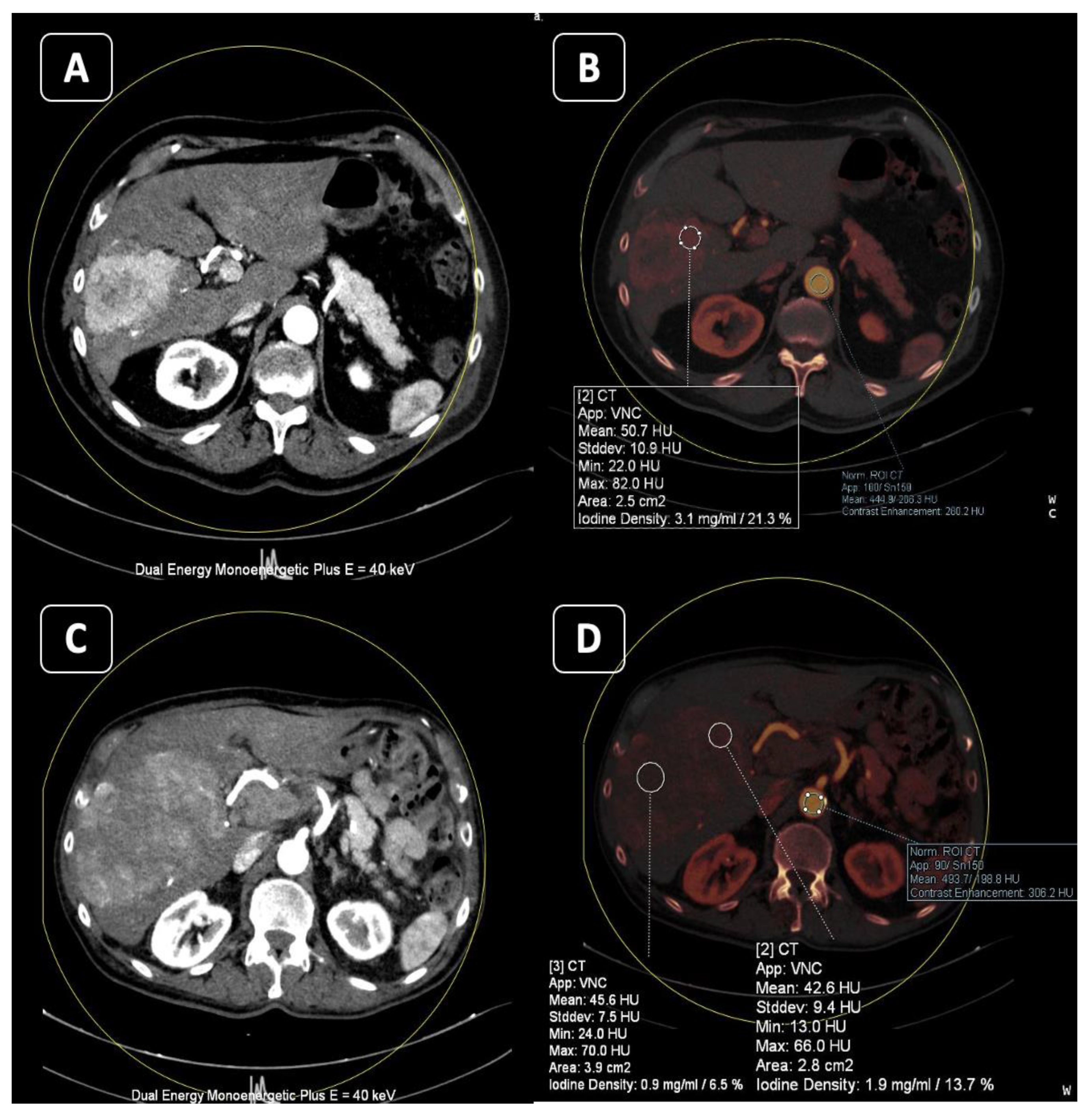 Tomography 10 00024 g007