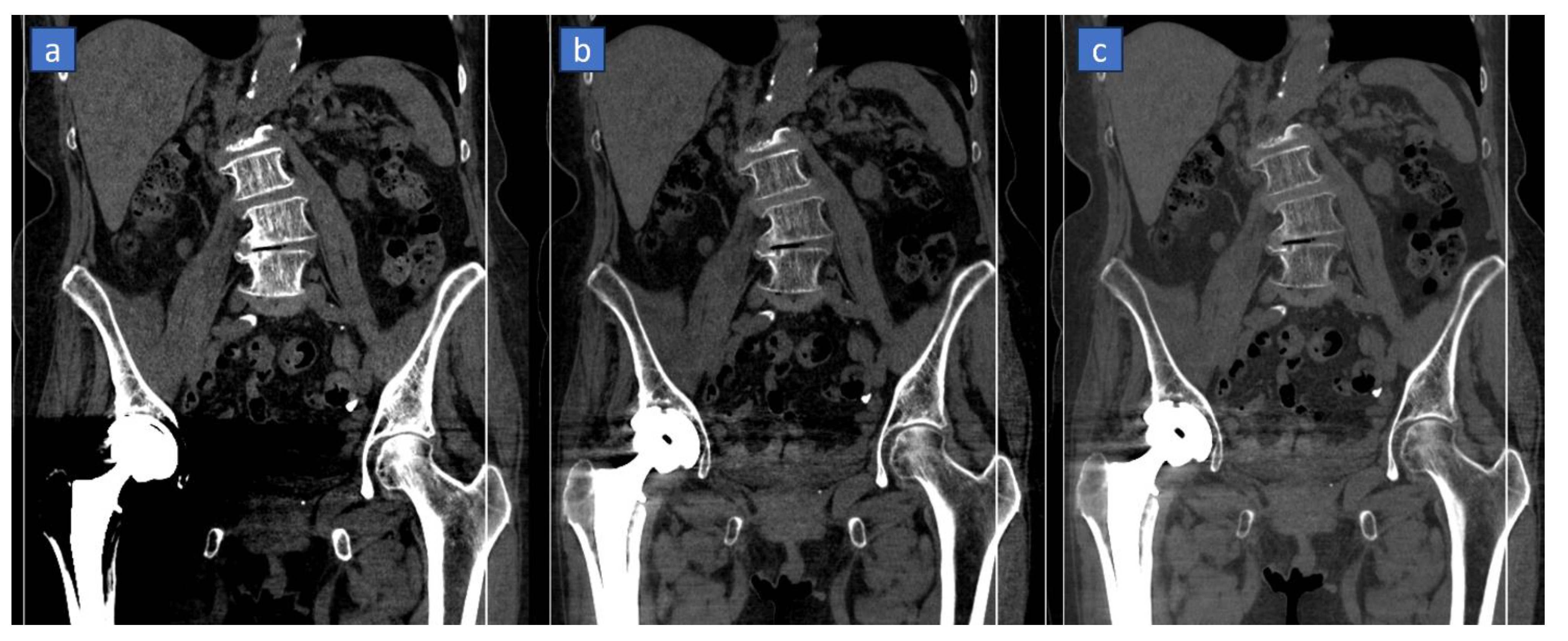 Tomography 10 00024 g008
