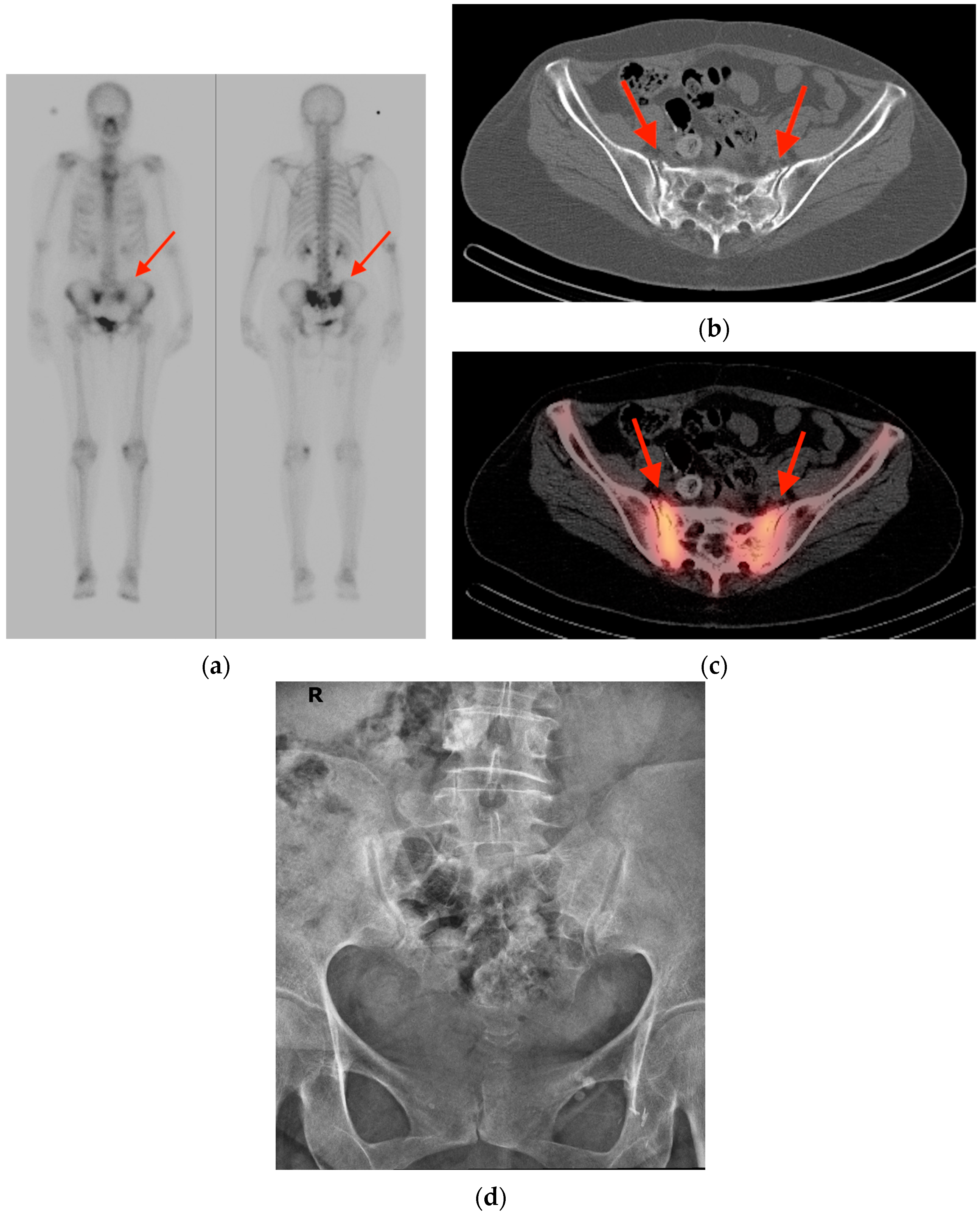 Tomography 10 00030 g001