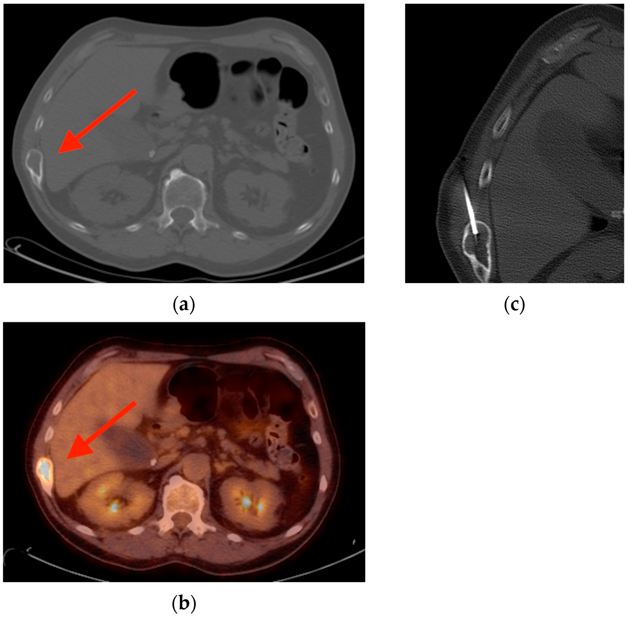 Tomography 10 00030 g002