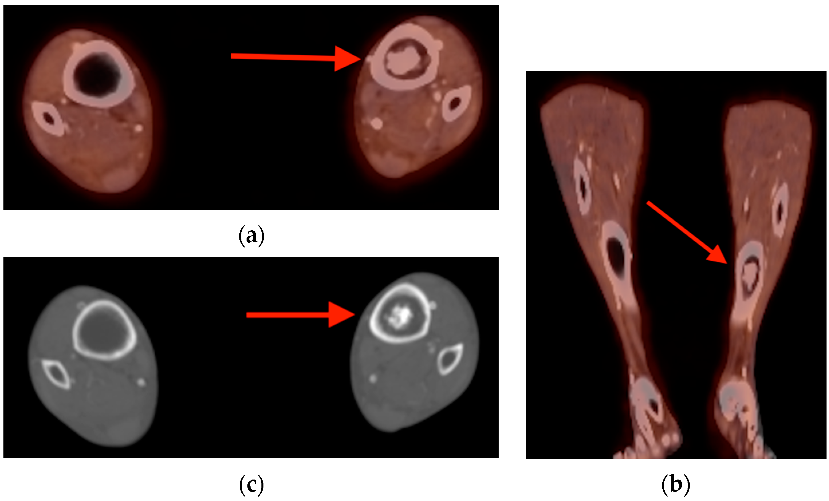 Tomography 10 00030 g004