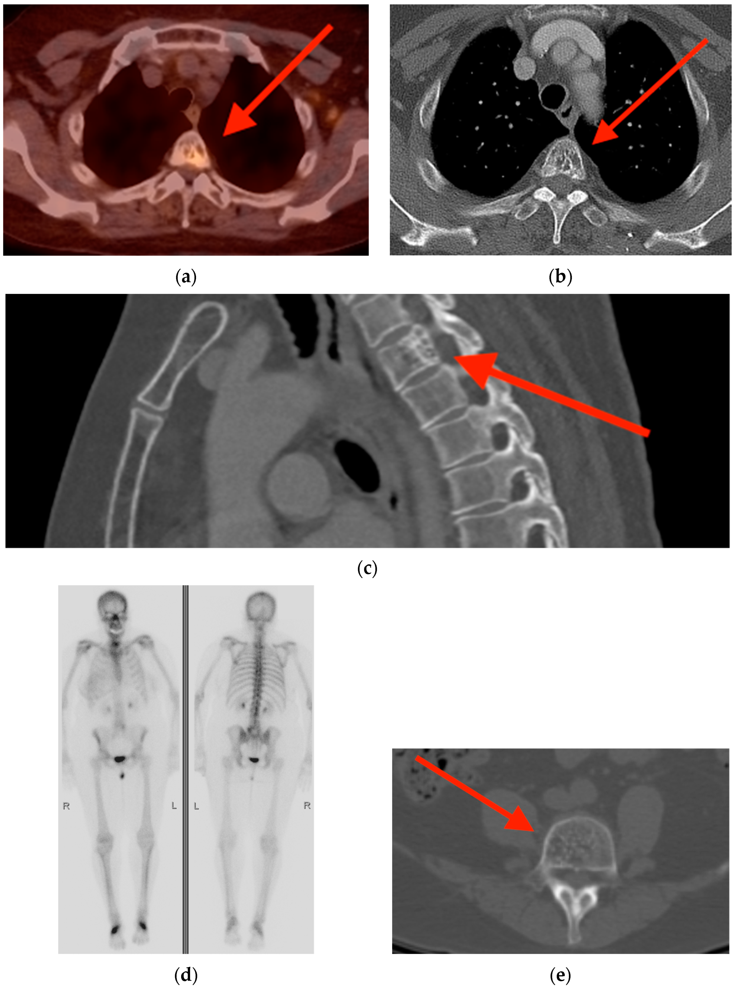 Tomography 10 00030 g006