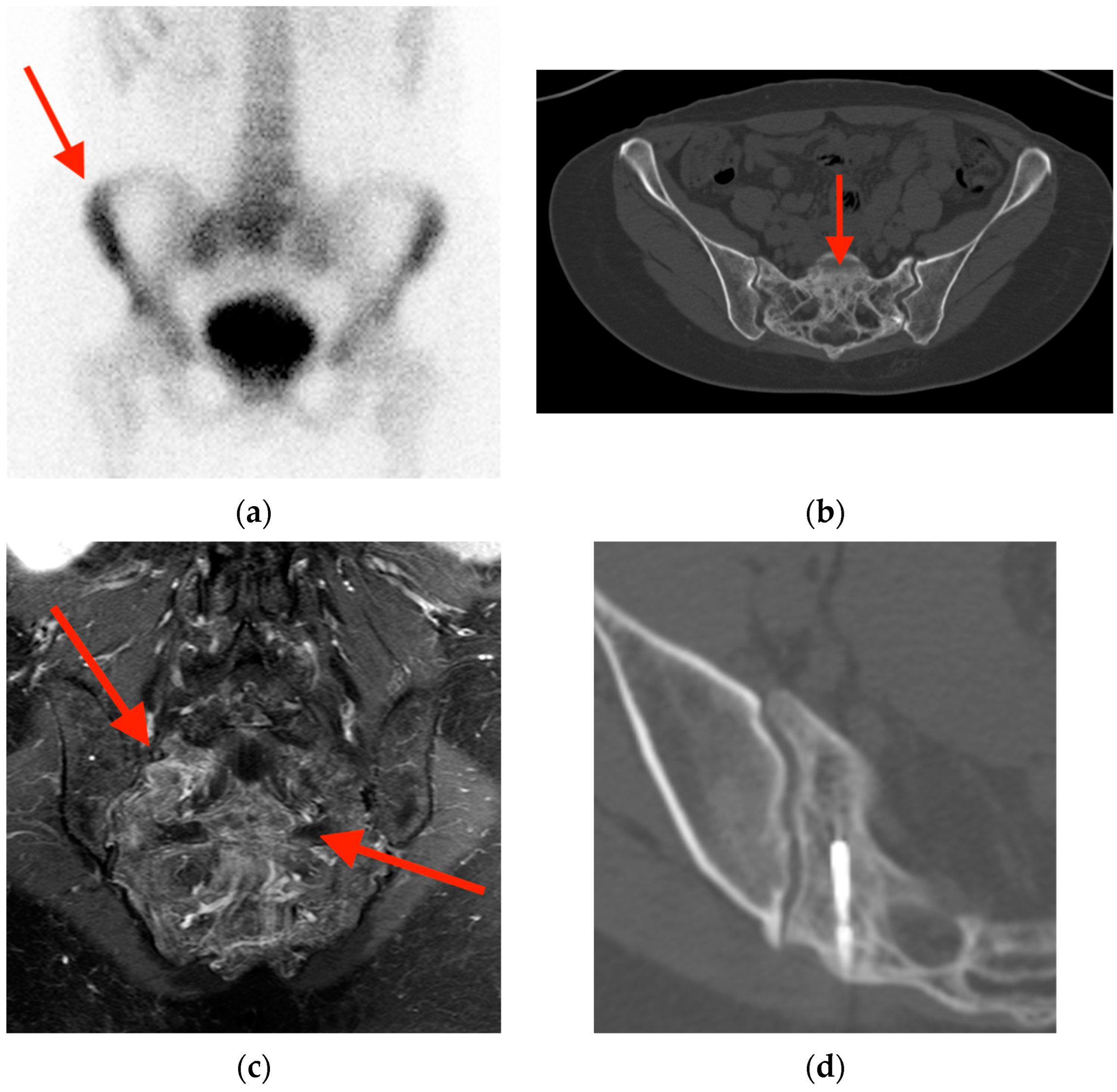 Tomography 10 00030 g007