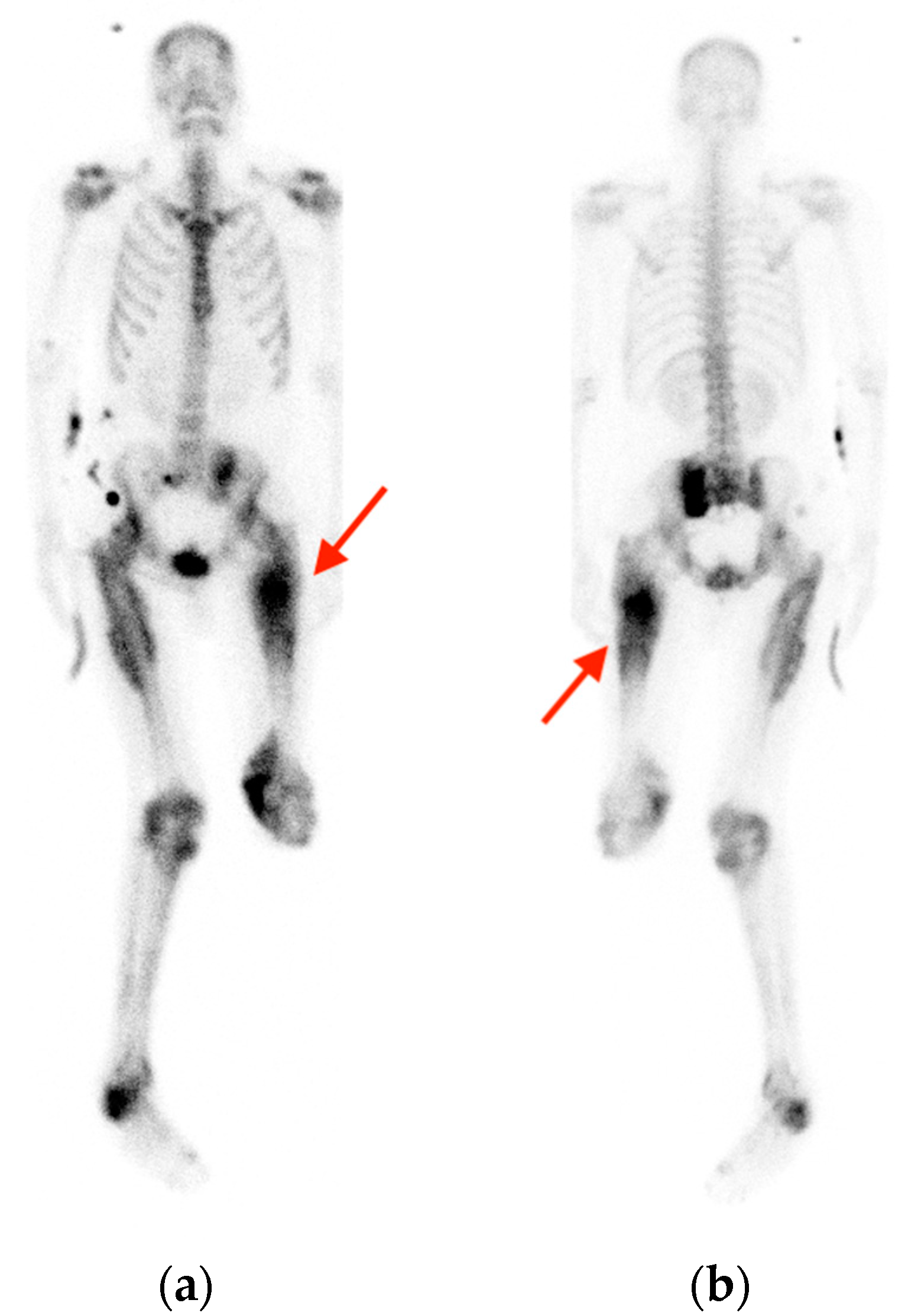 Tomography 10 00030 g010