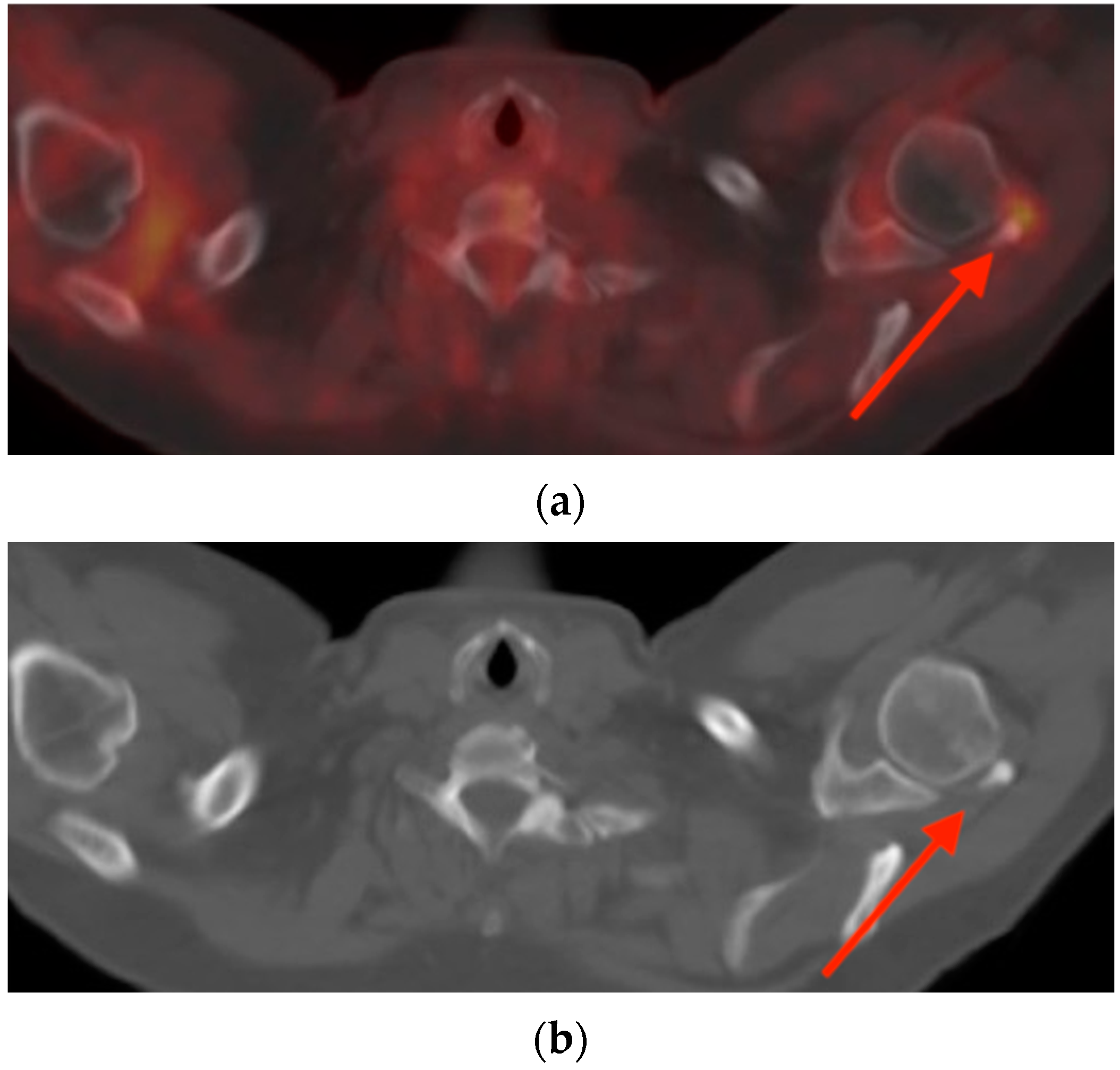 Tomography 10 00030 g011