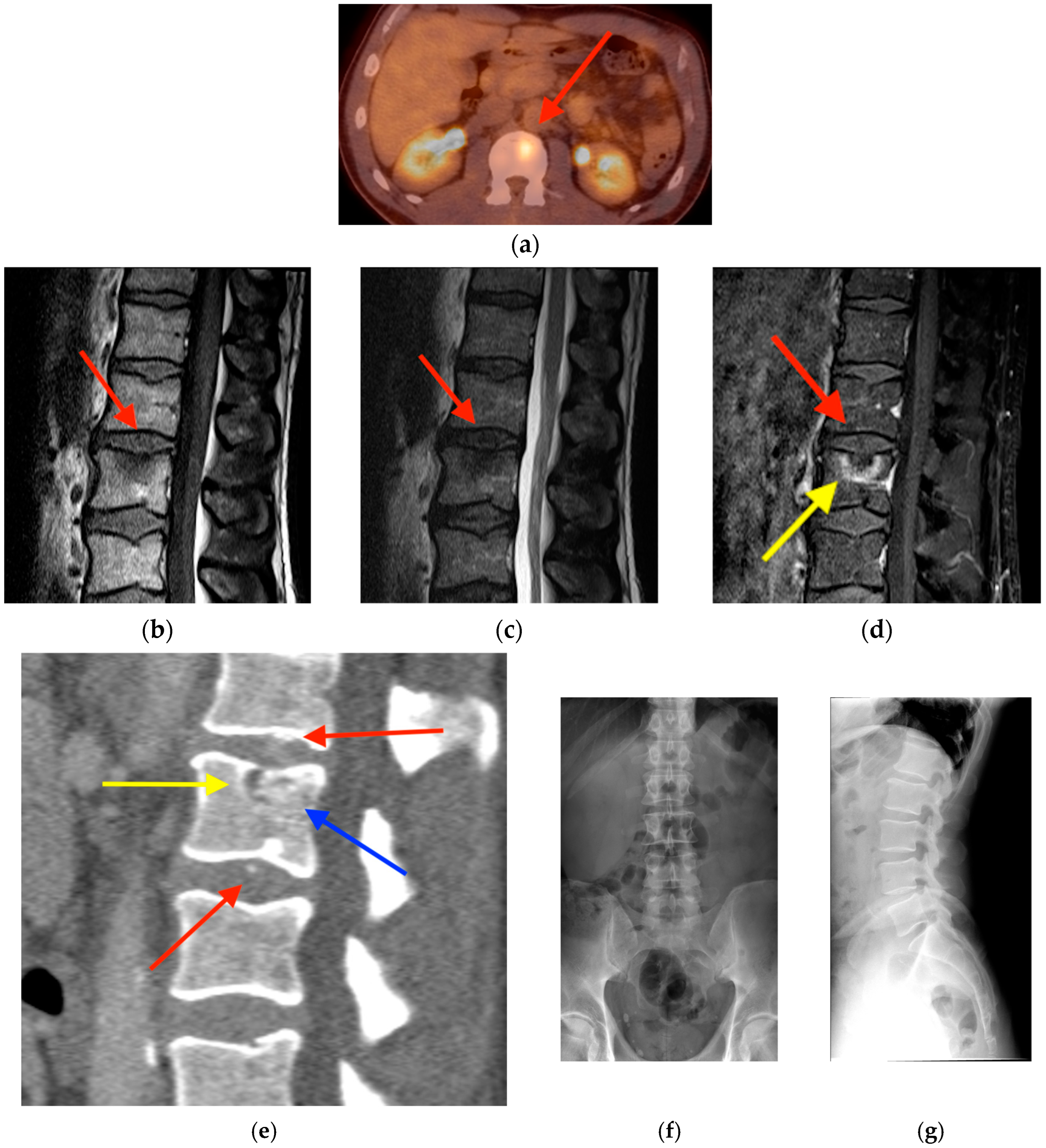 Tomography 10 00030 g014