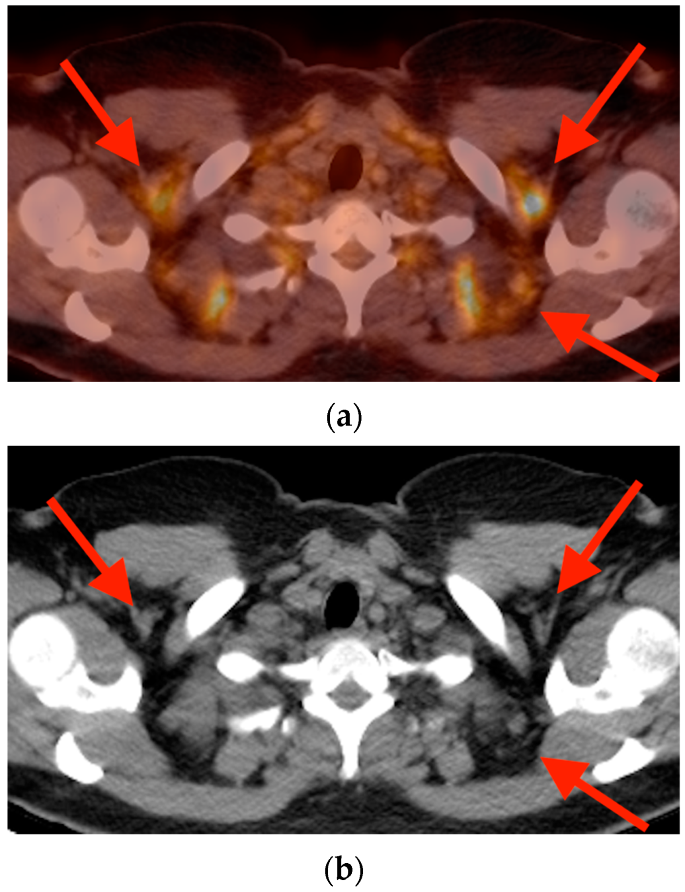 Tomography 10 00030 g016