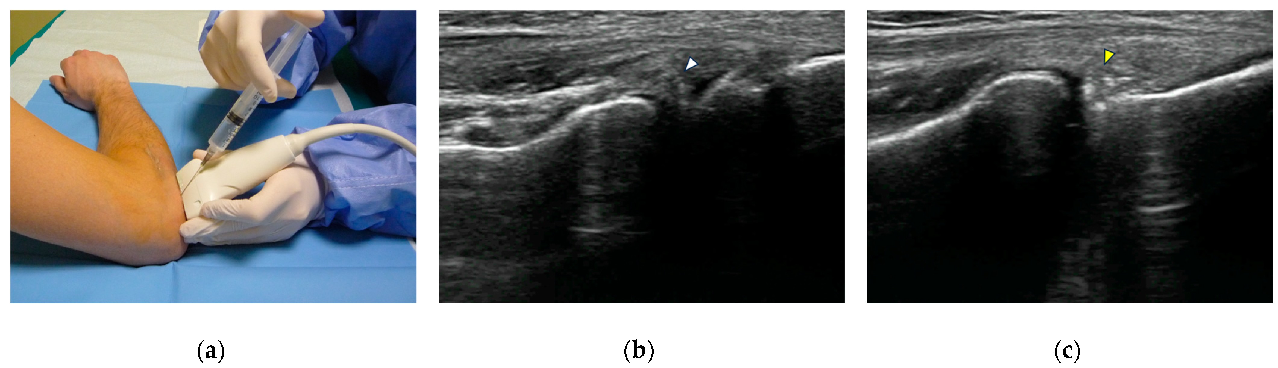 Tomography 10 00032 g001