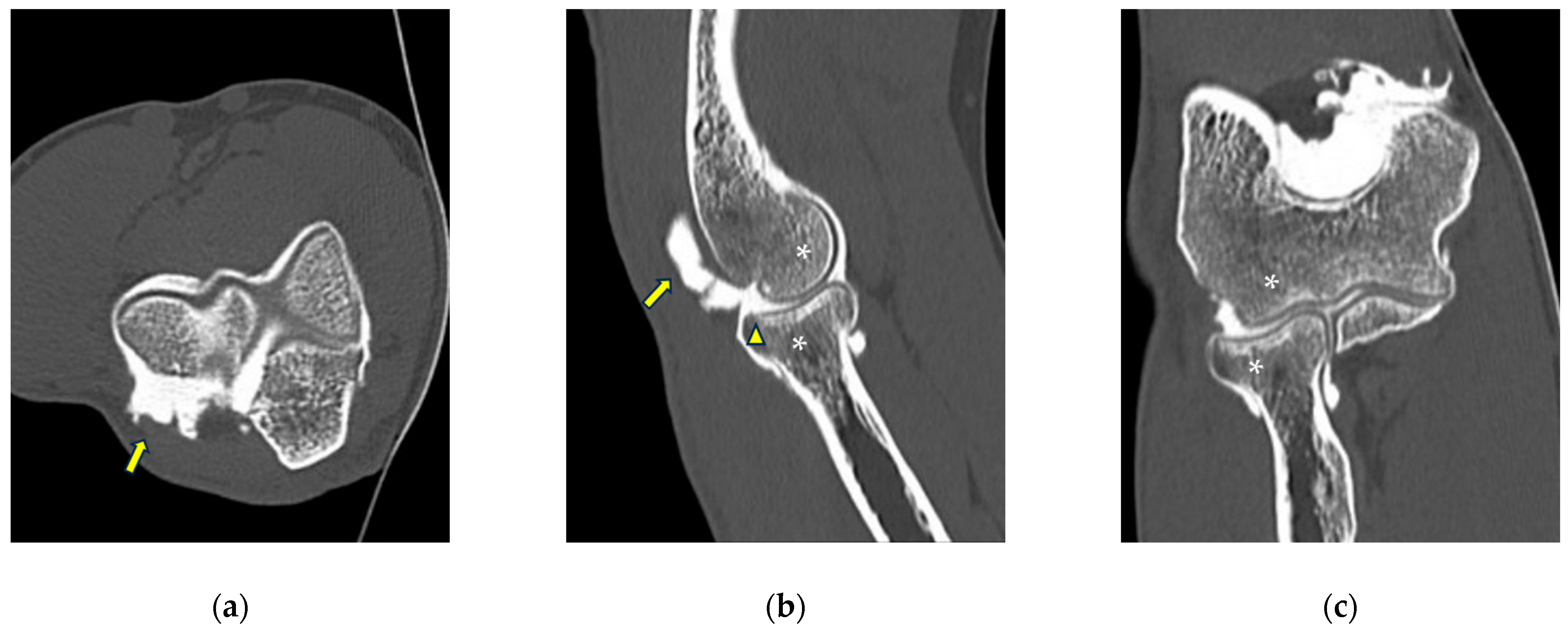 Tomography 10 00032 g006