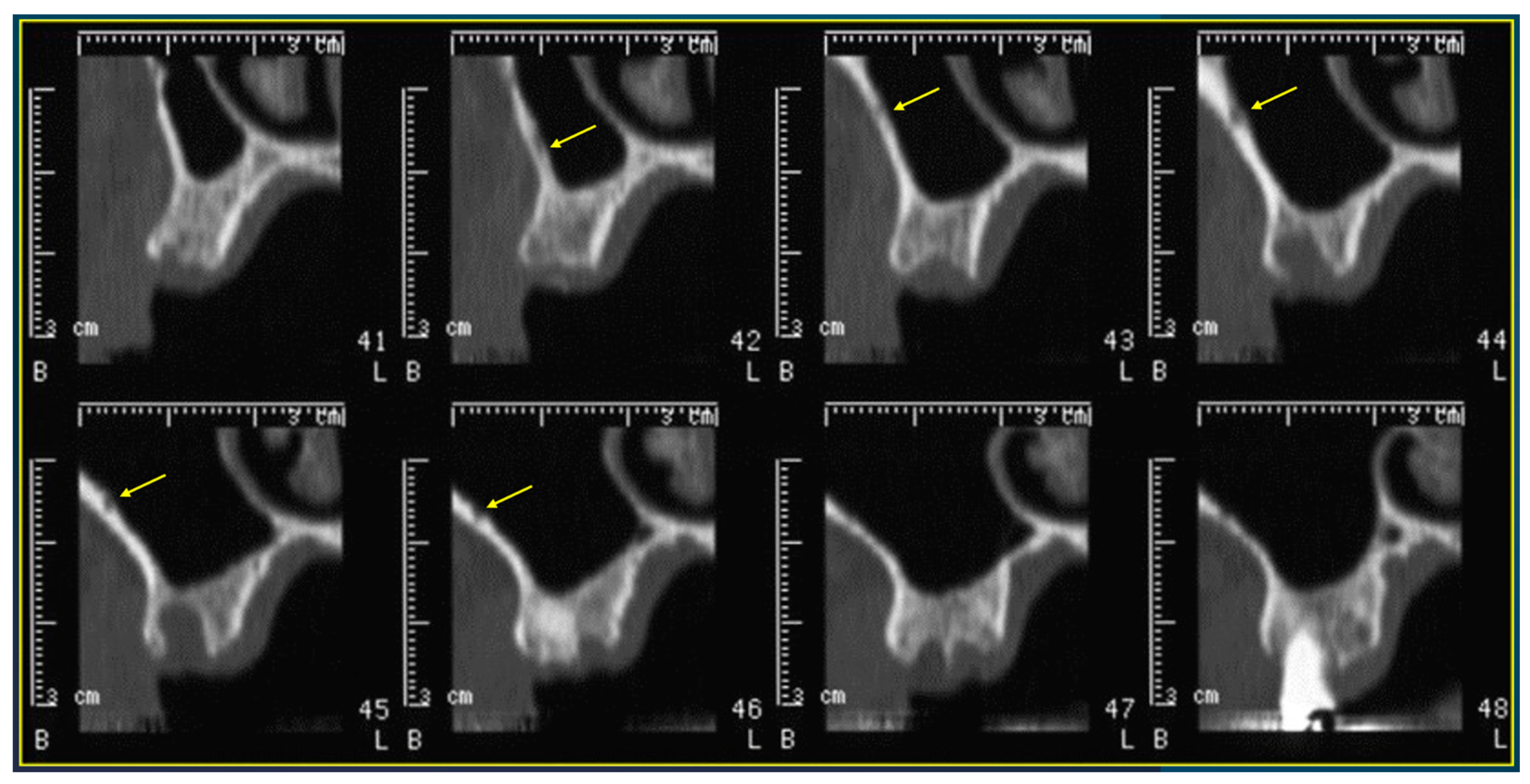 Tomography 10 00034 g002