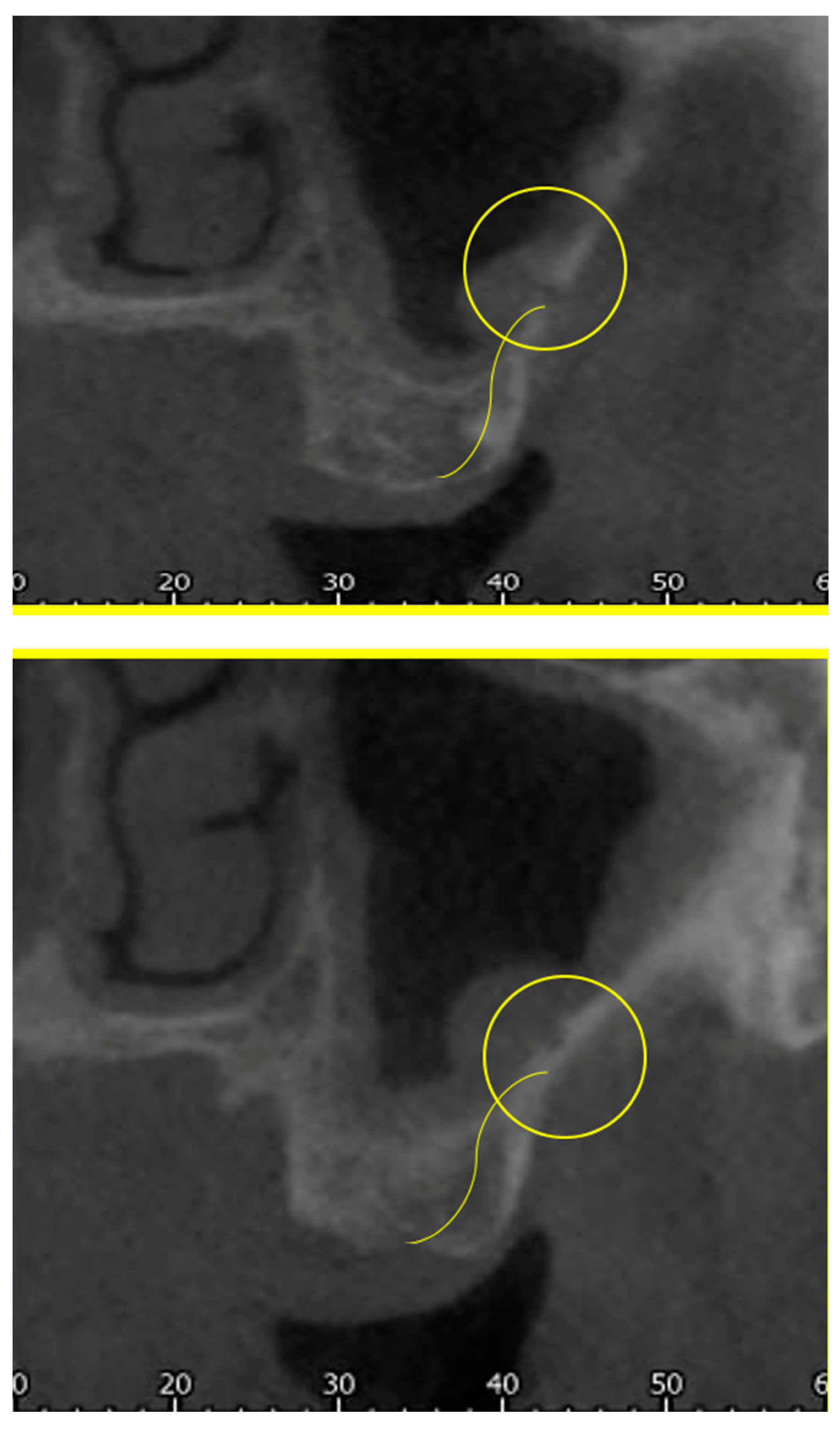 Tomography 10 00034 g003
