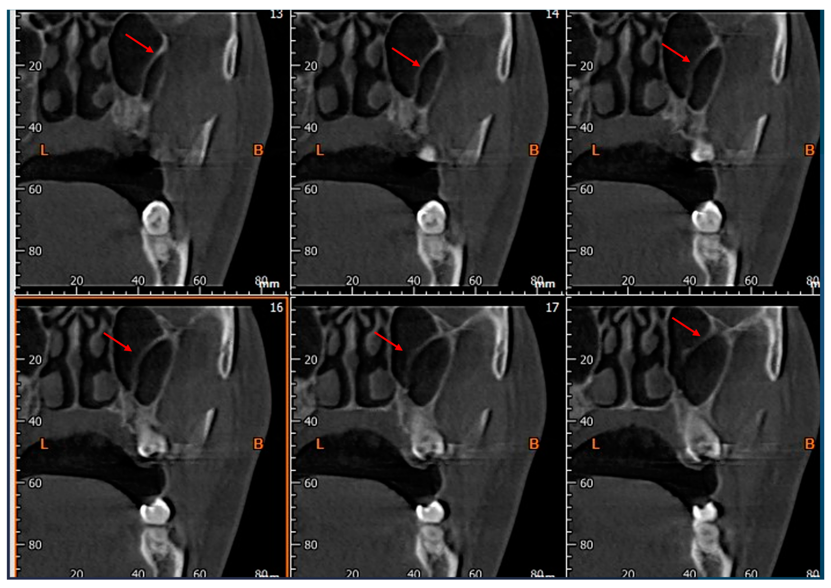 Tomography 10 00034 g004