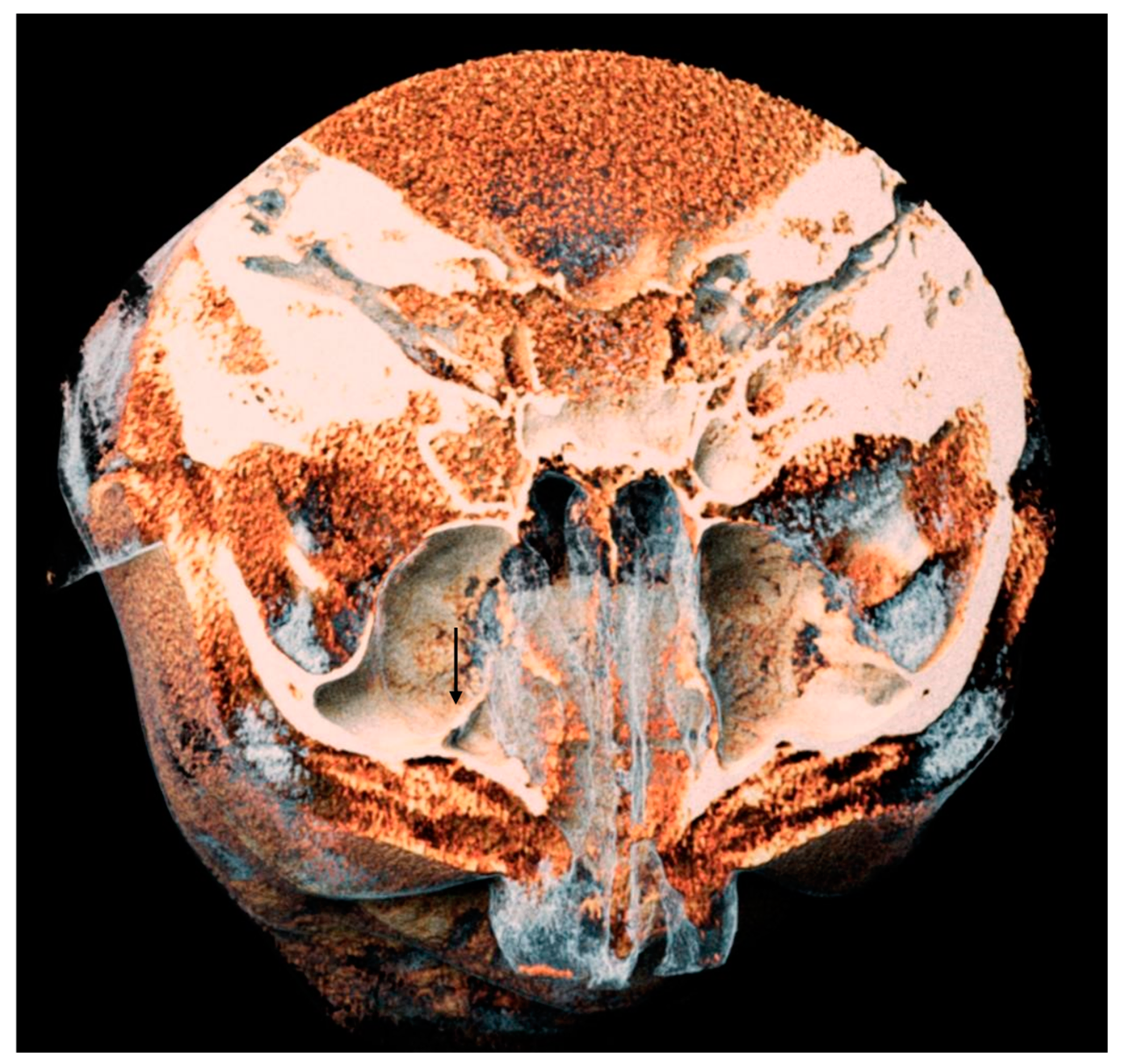 Tomography 10 00034 g006