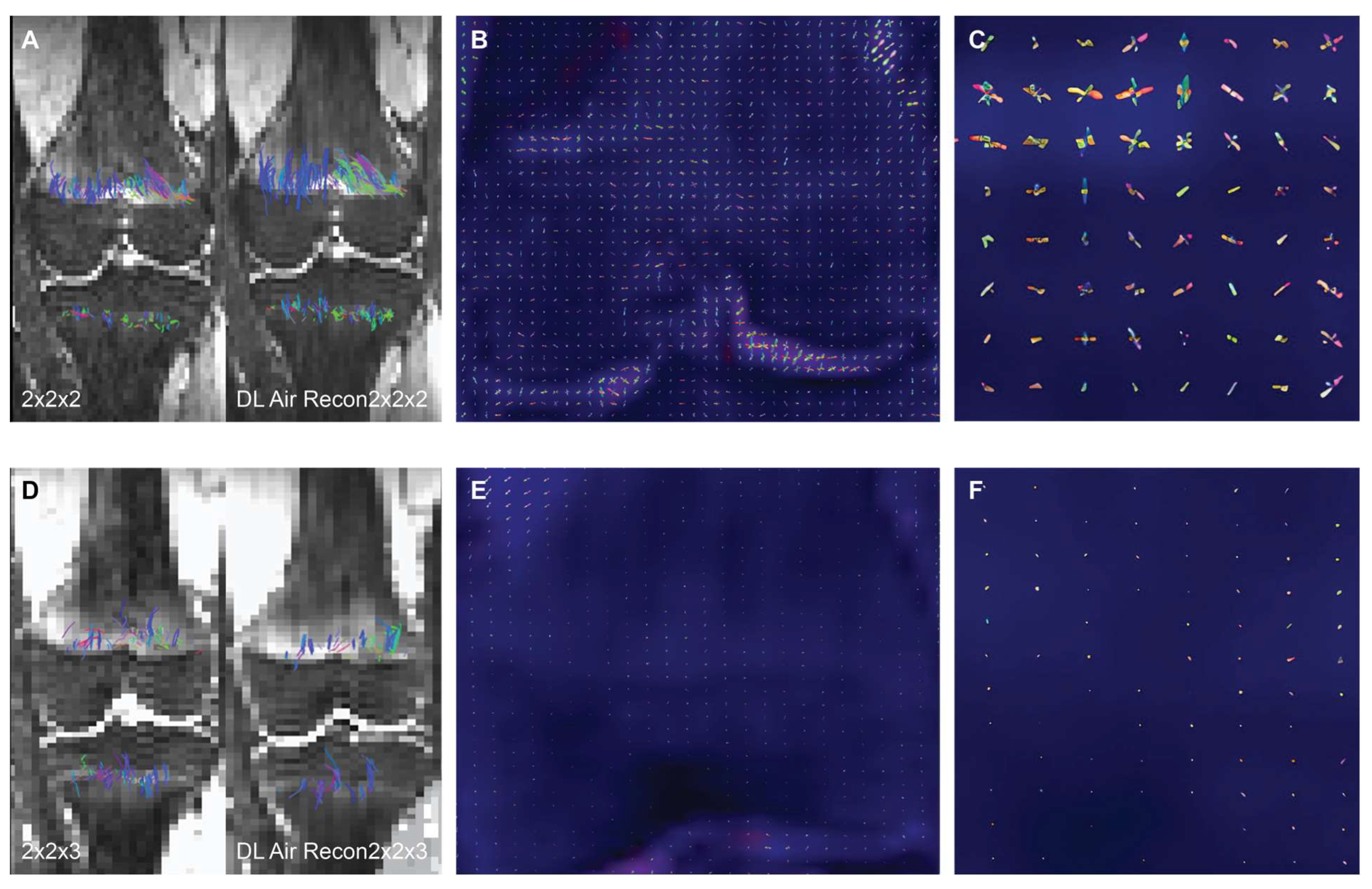 Tomography 10 00039 g001