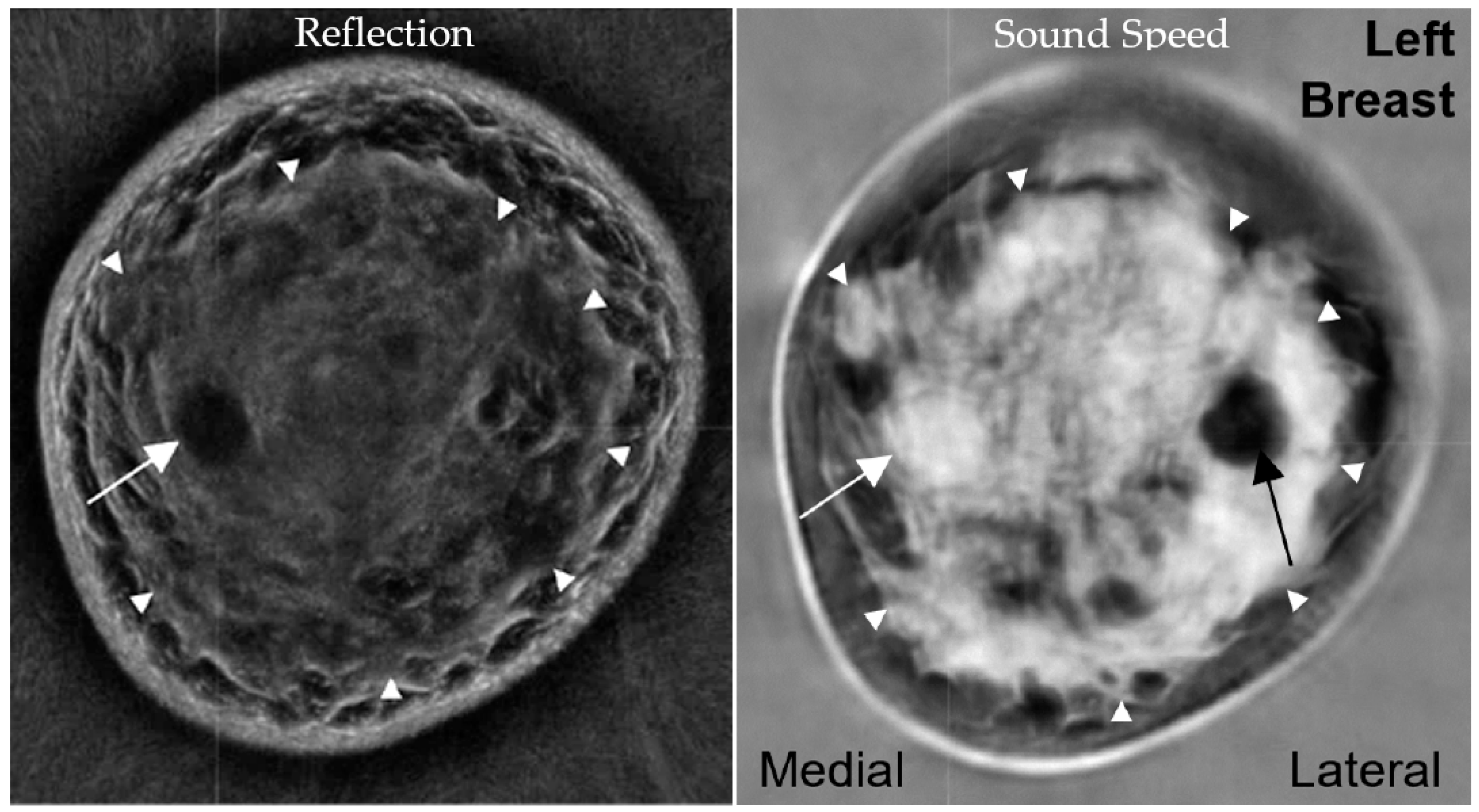 Tomography 10 00044 g004