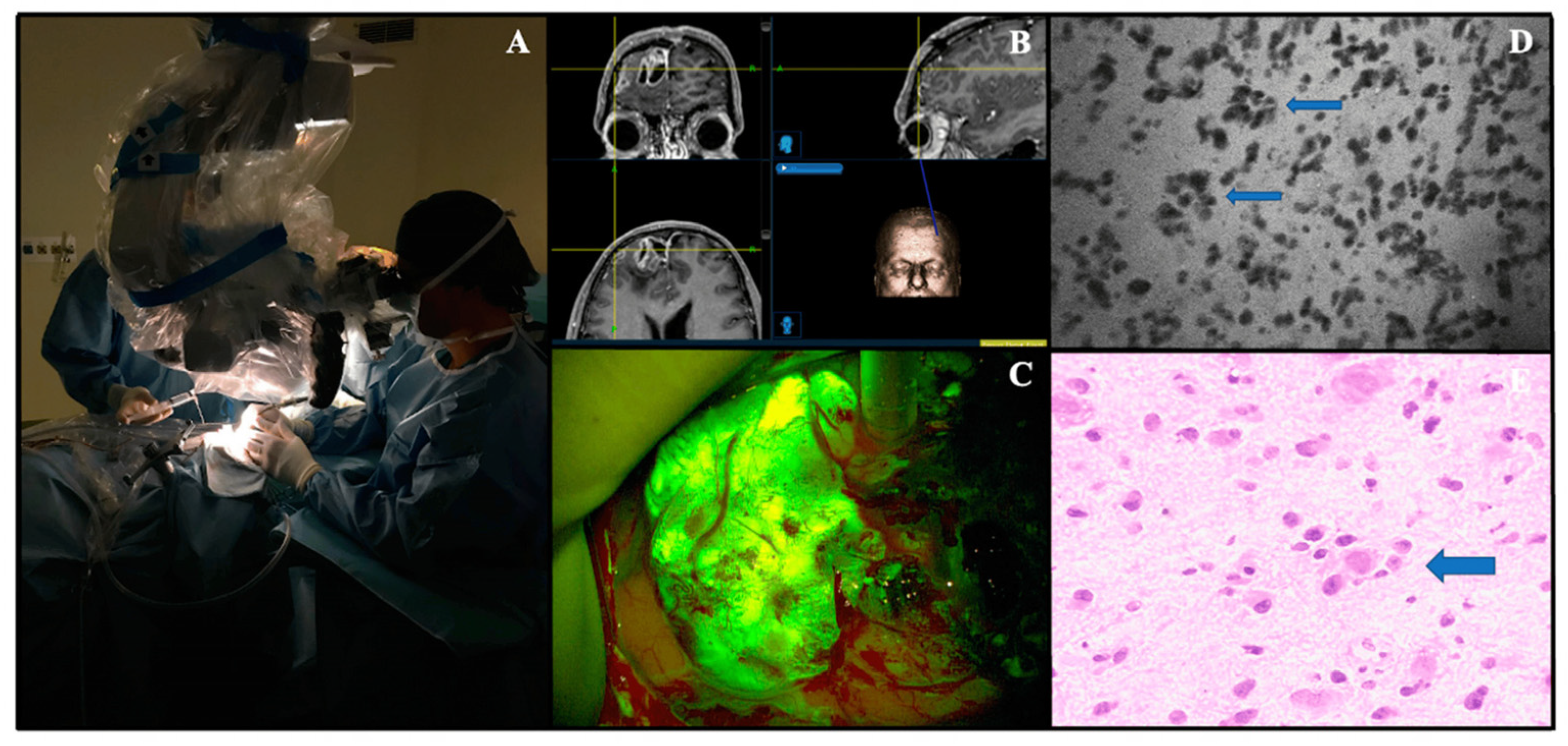 Tomography 10 00054 g002 Tomography 10 00054 g002