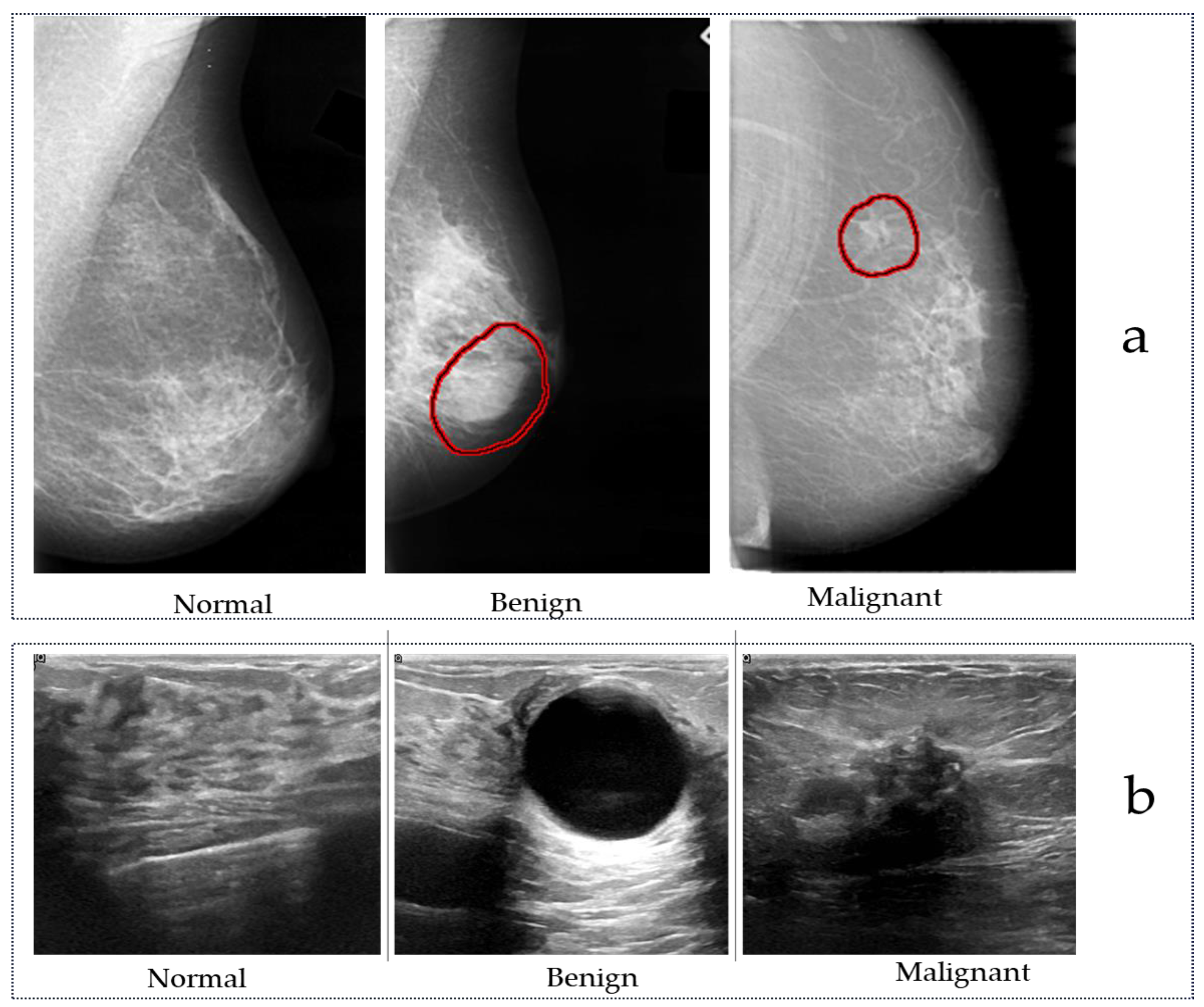 Tomography 10 00055 g002