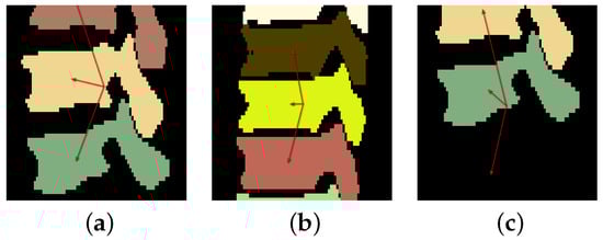 Tomography 10 00057 g005