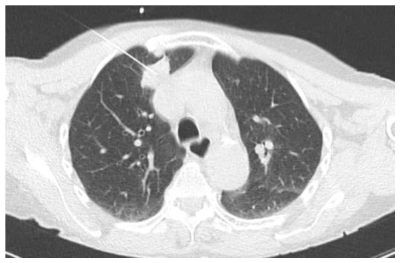 Tomography 10 00058 g001