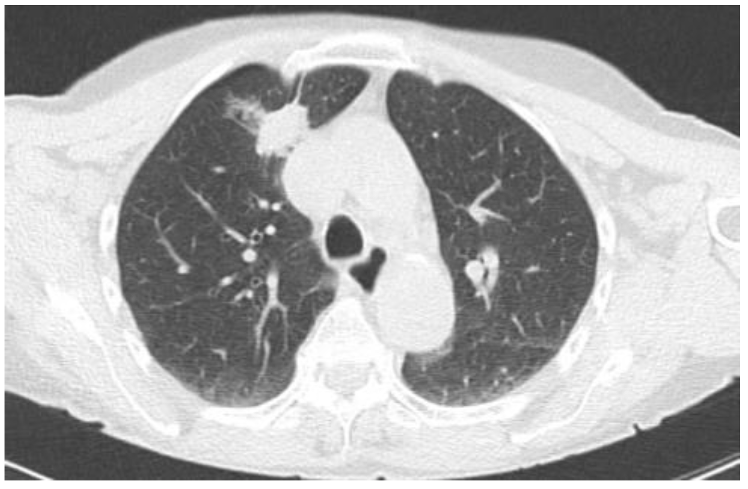 Tomography 10 00058 g003
