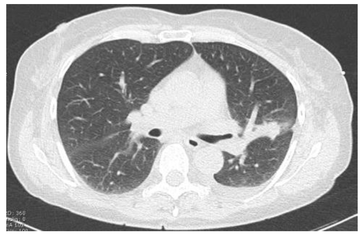 Tomography 10 00058 g004
