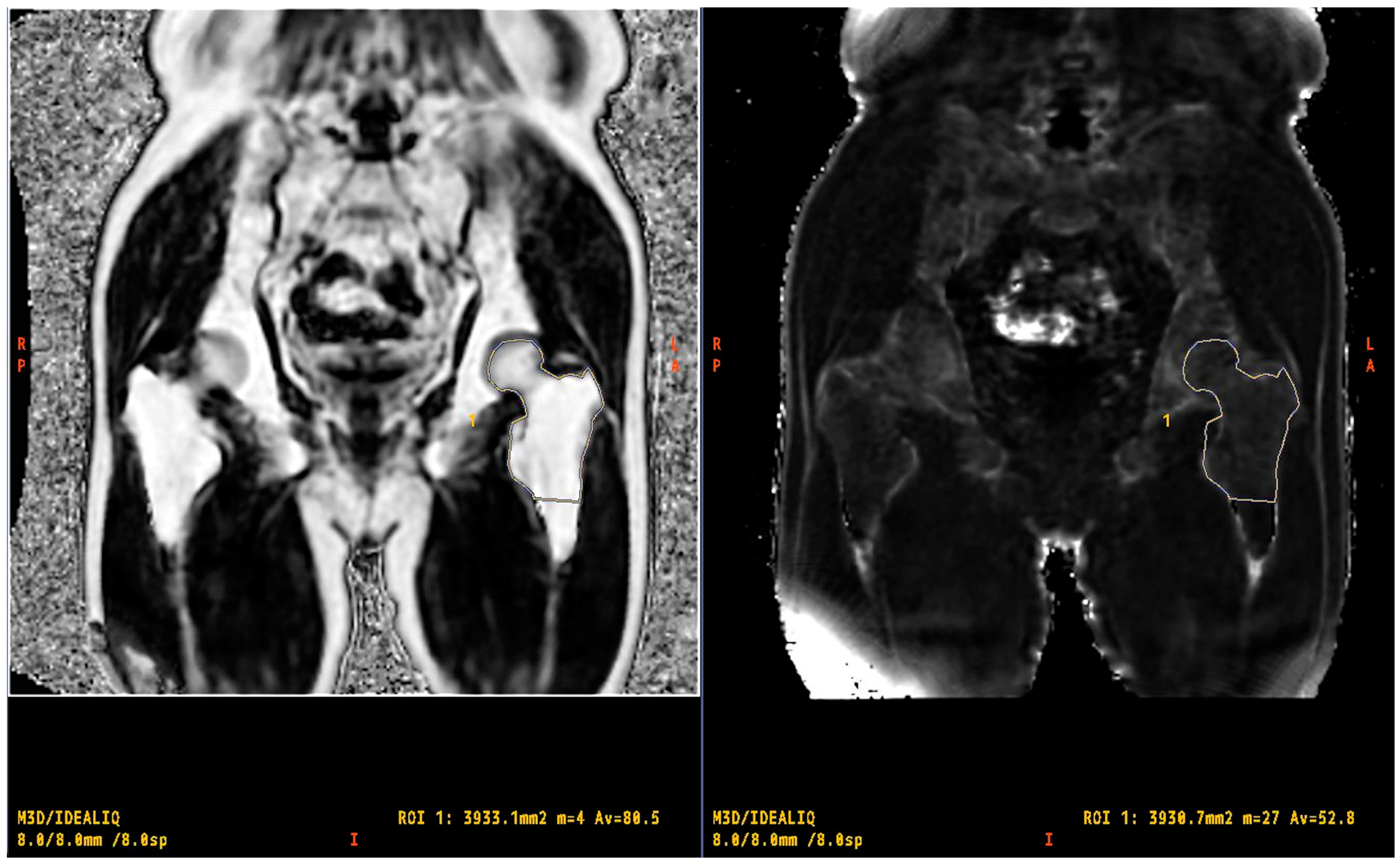 Tomography 10 00062 g001 Tomography 10 00062 g001
