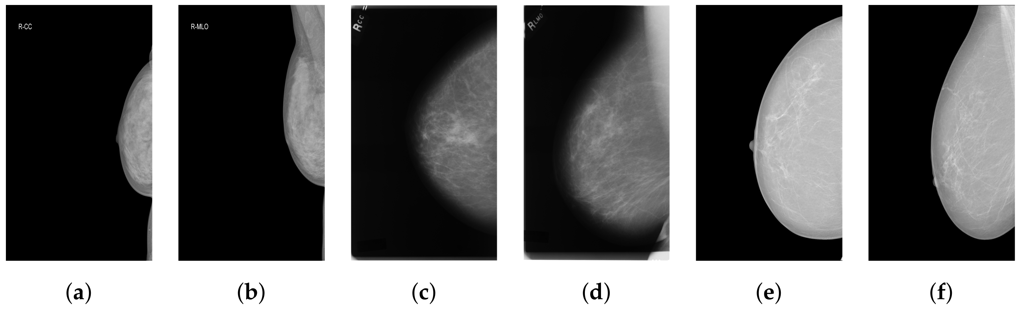 Tomography 10 00065 g001