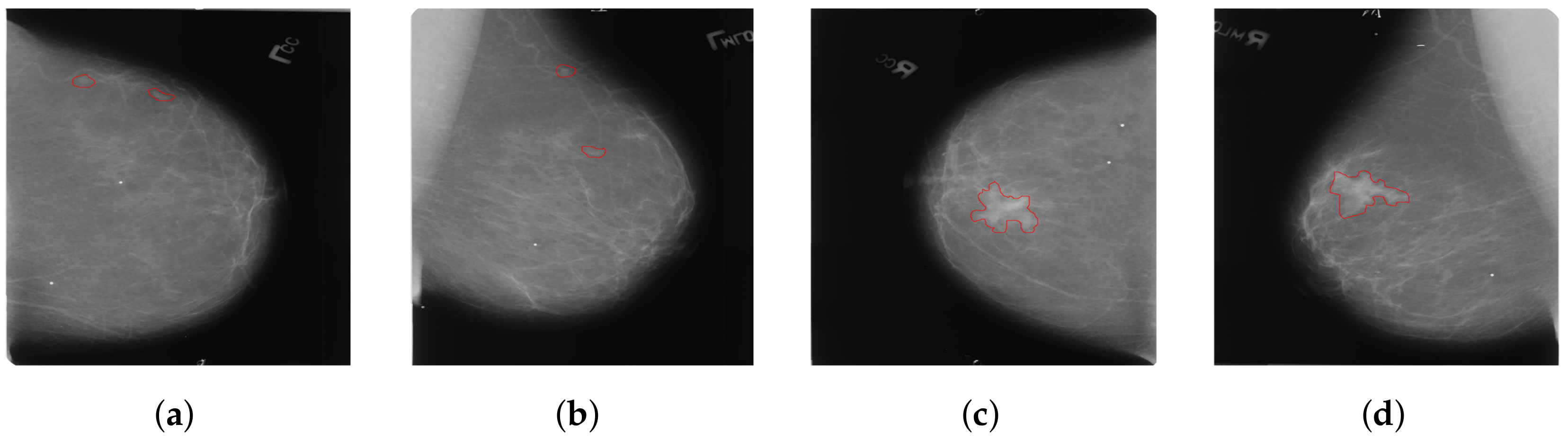 Tomography 10 00065 g003