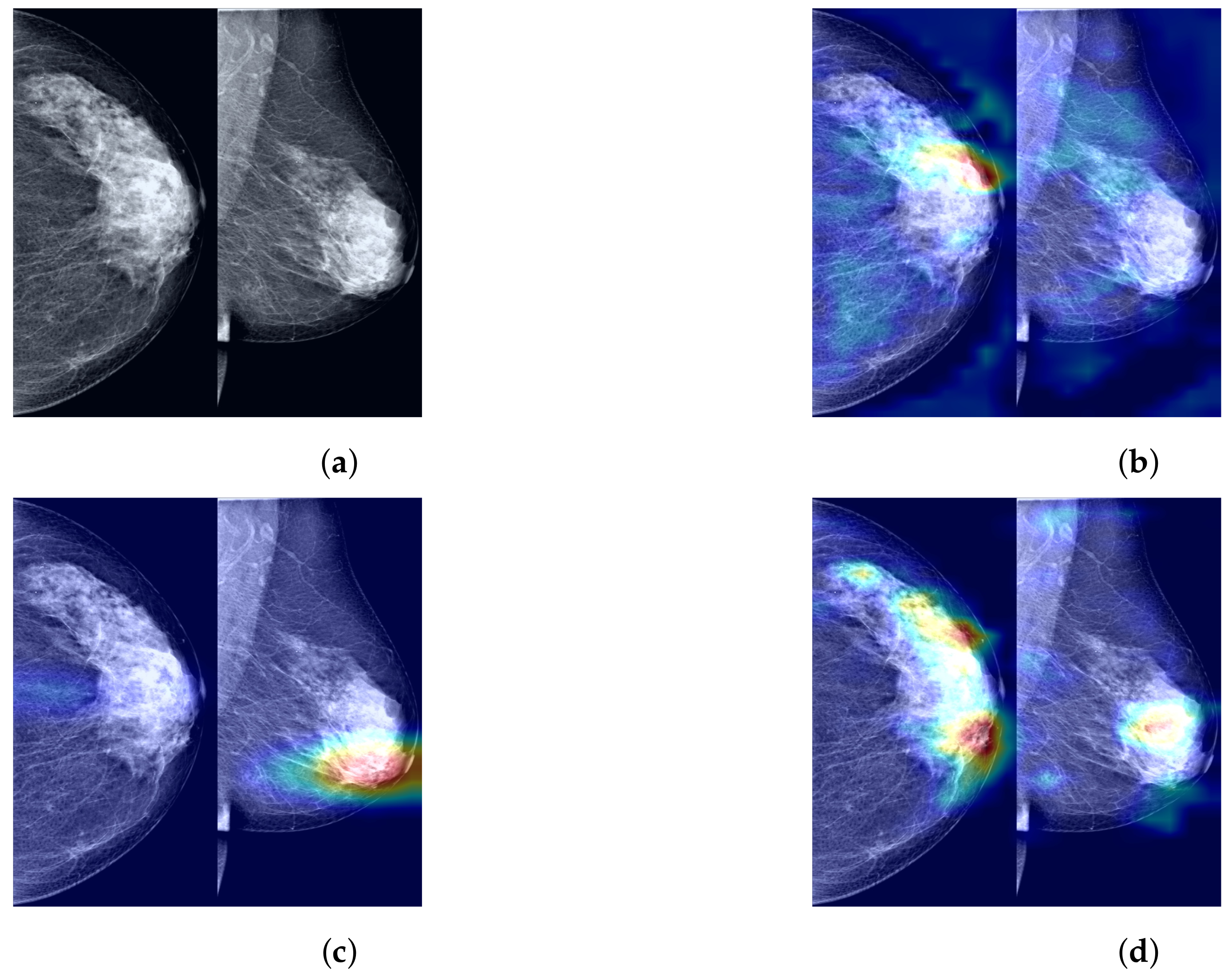 Tomography 10 00065 g007