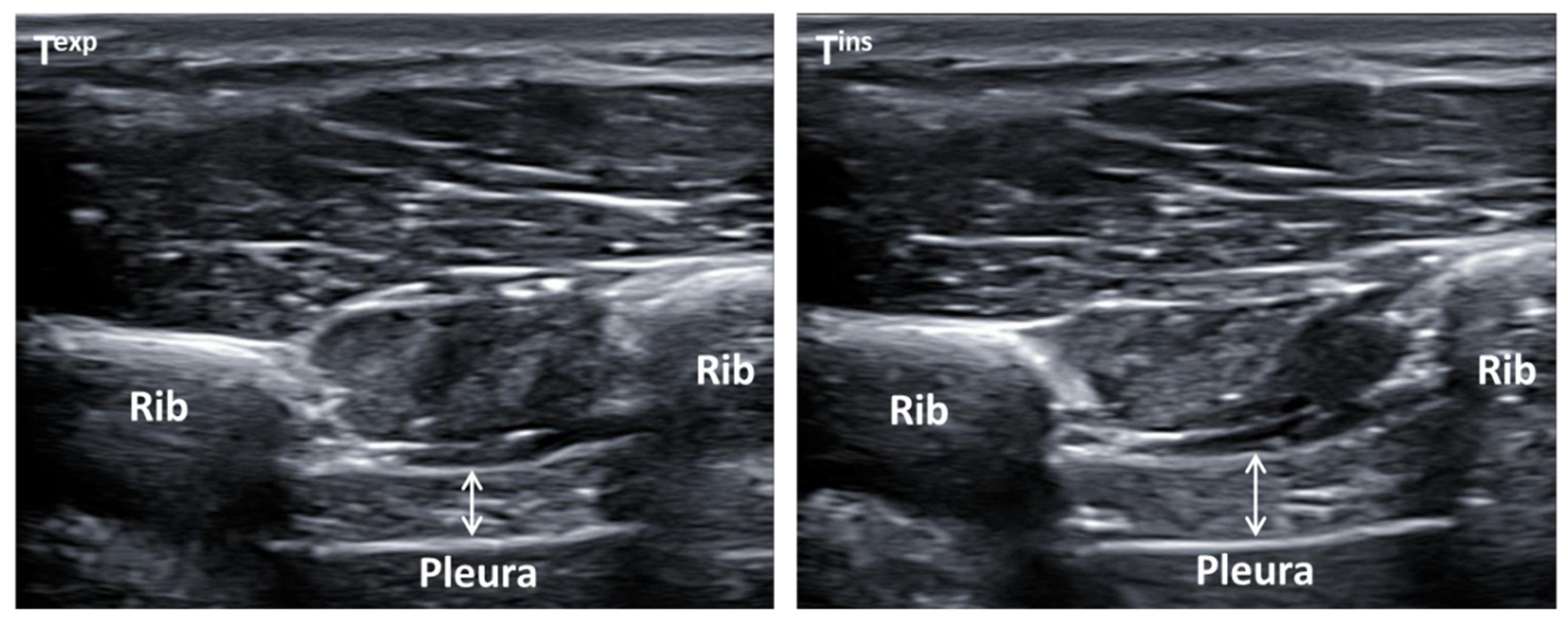 Tomography 10 00067 g001