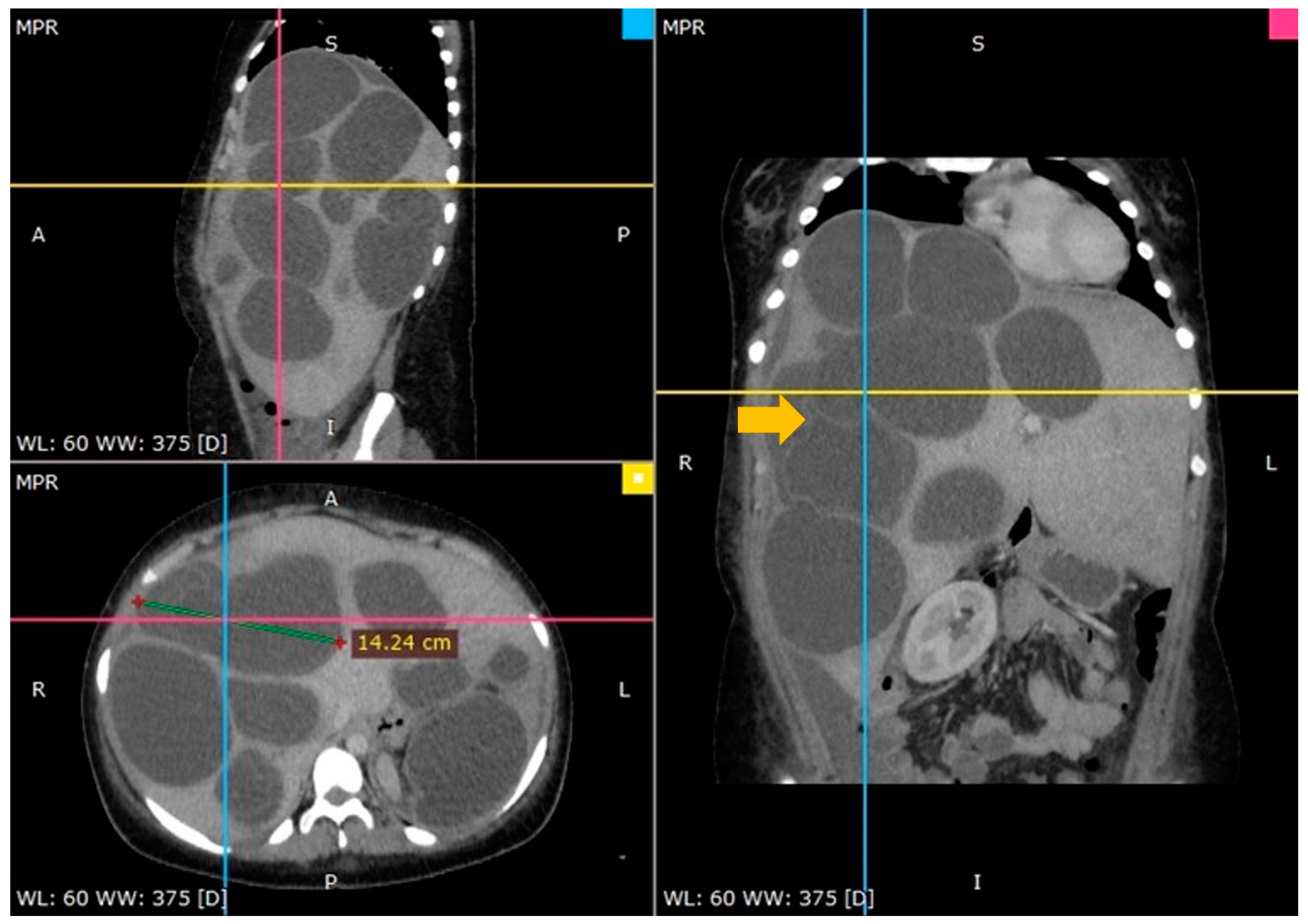 Tomography 10 00070 g001