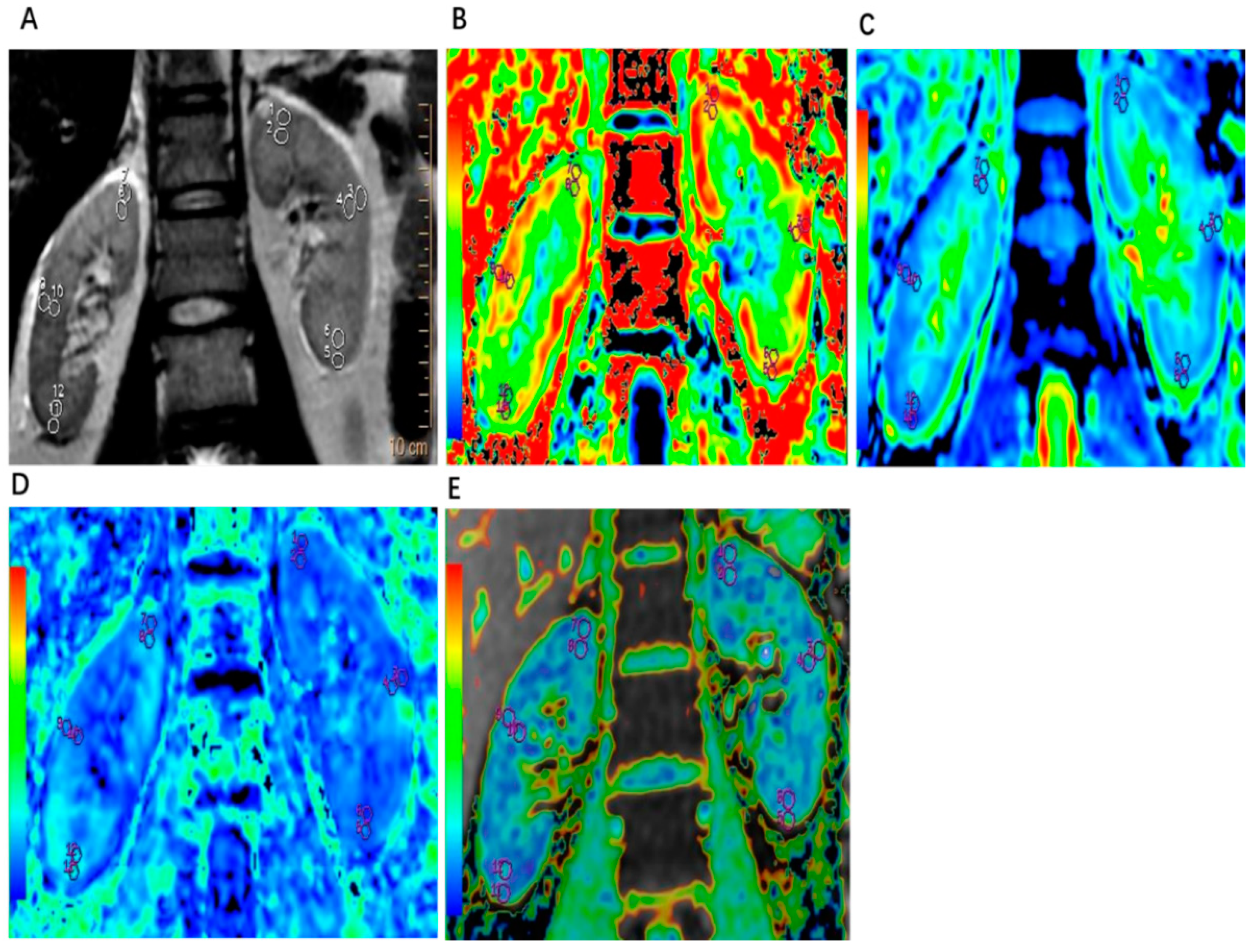 Tomography 10 00073 g001 Tomography 10 00073 g001