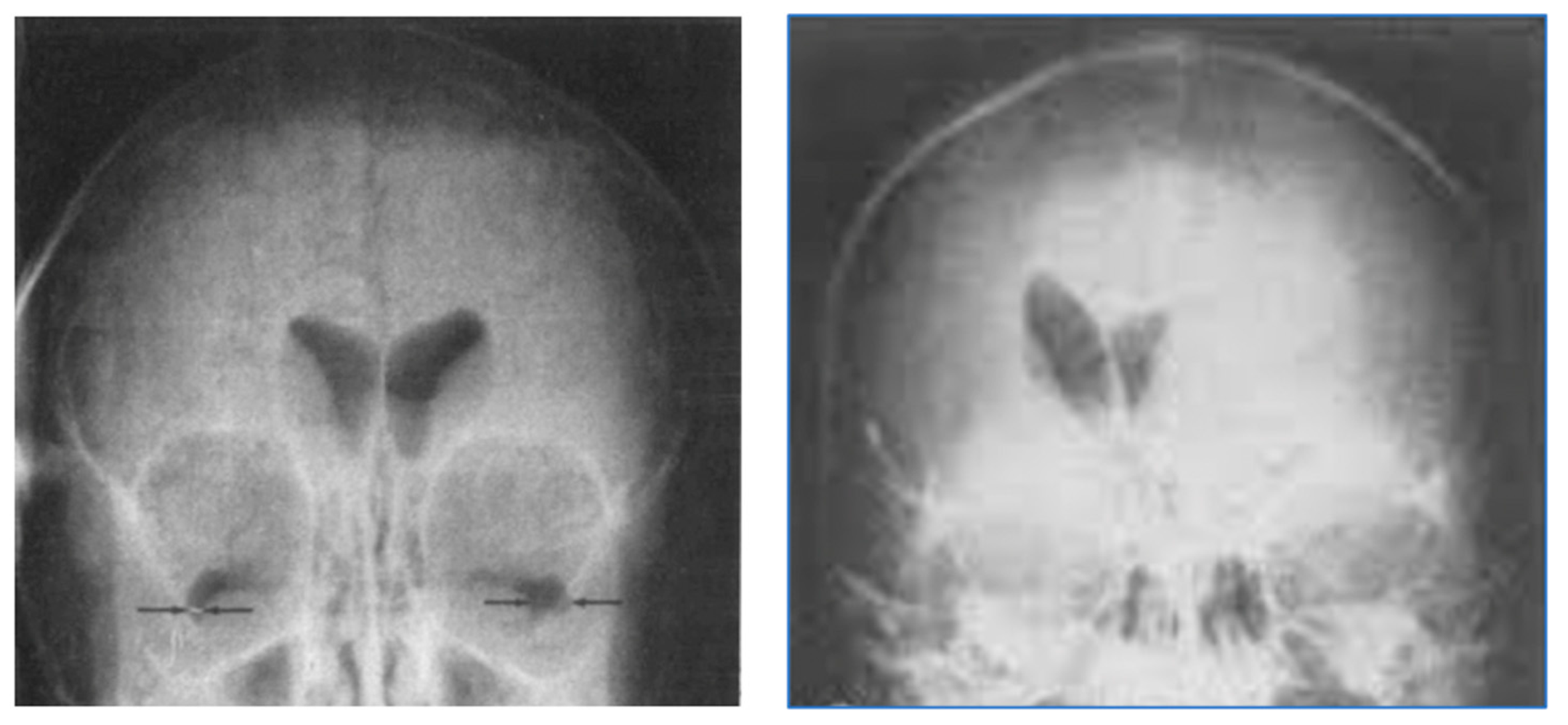 Tomography 10 00074 g003