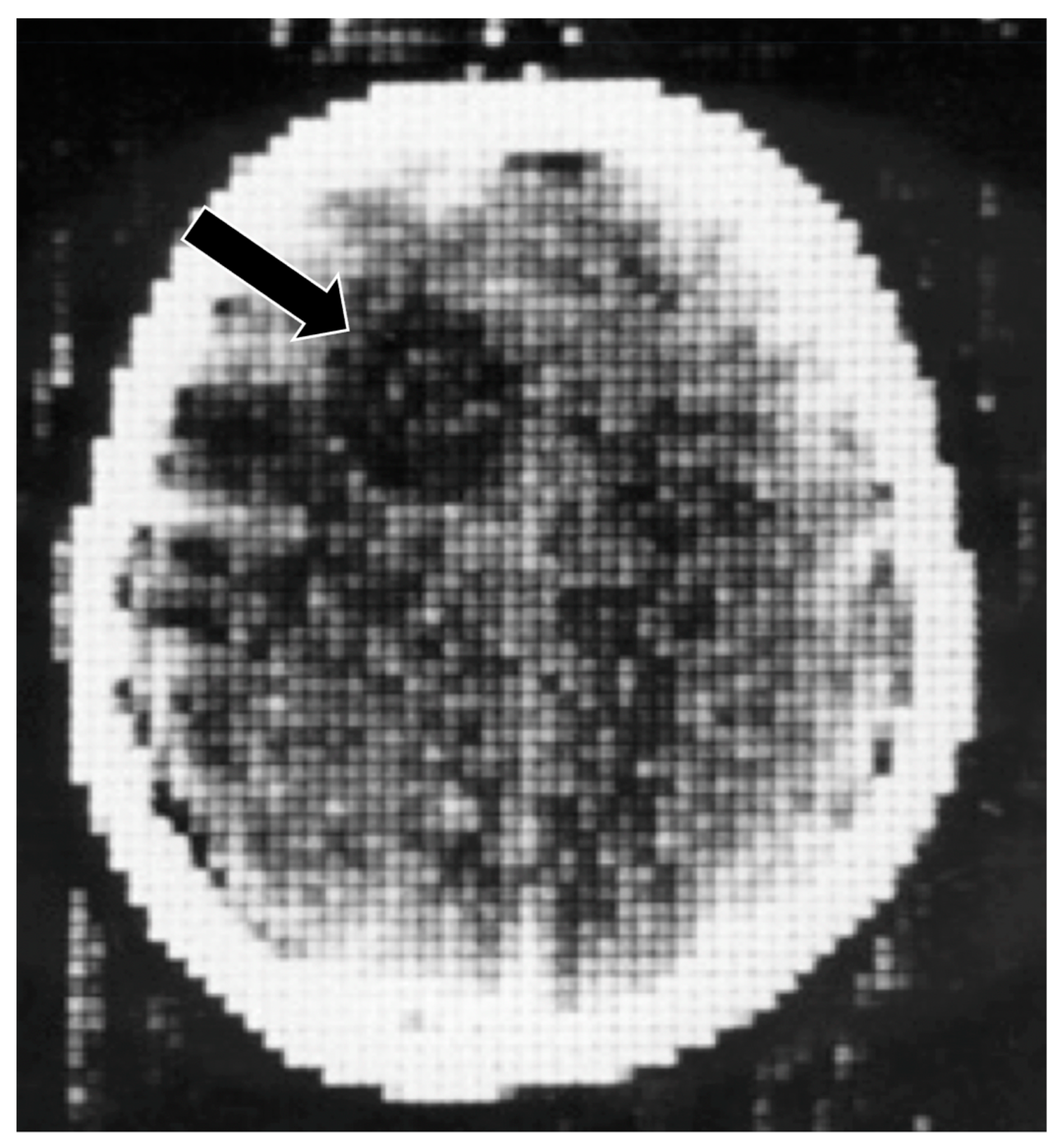Tomography 10 00074 g005