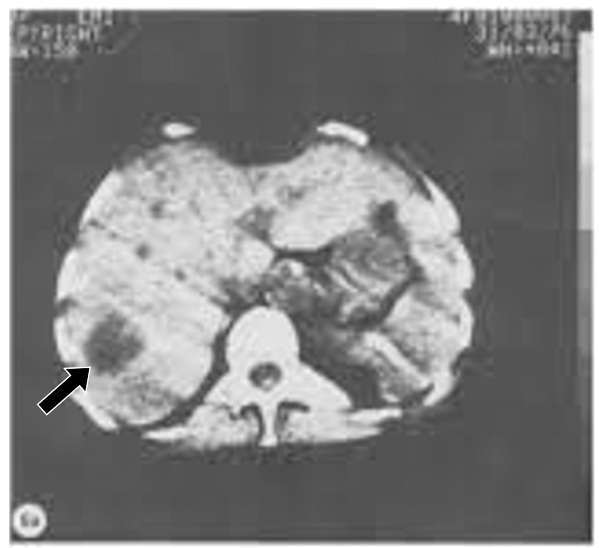 Tomography 10 00074 g006