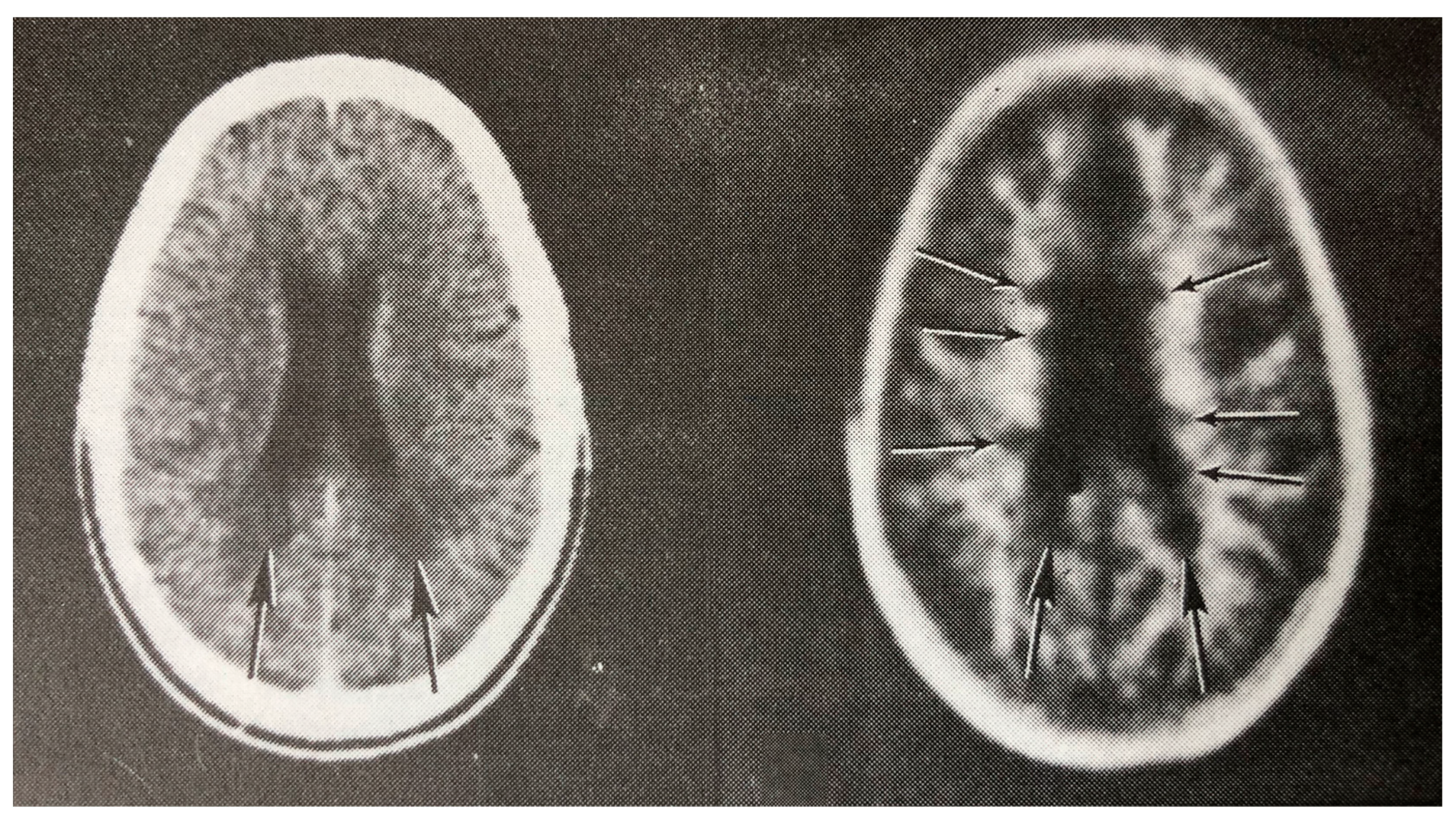 Tomography 10 00074 g007