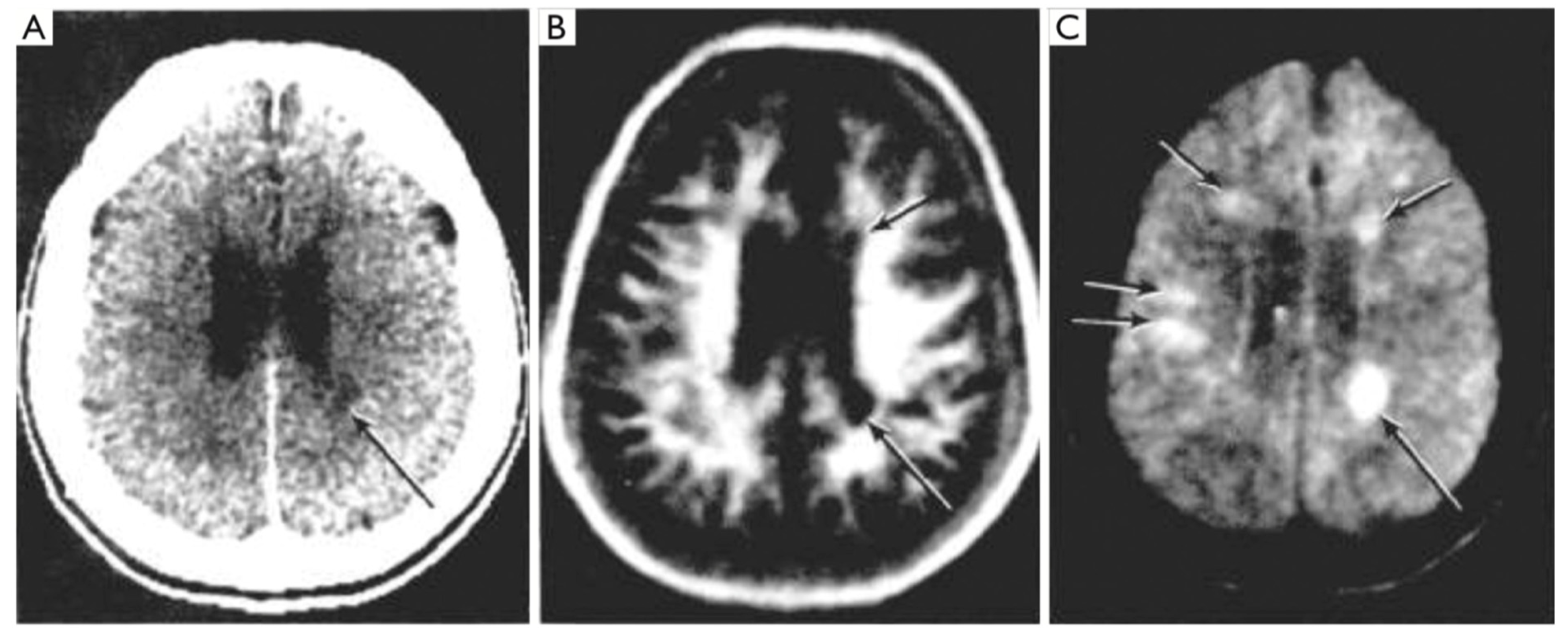 Tomography 10 00074 g008